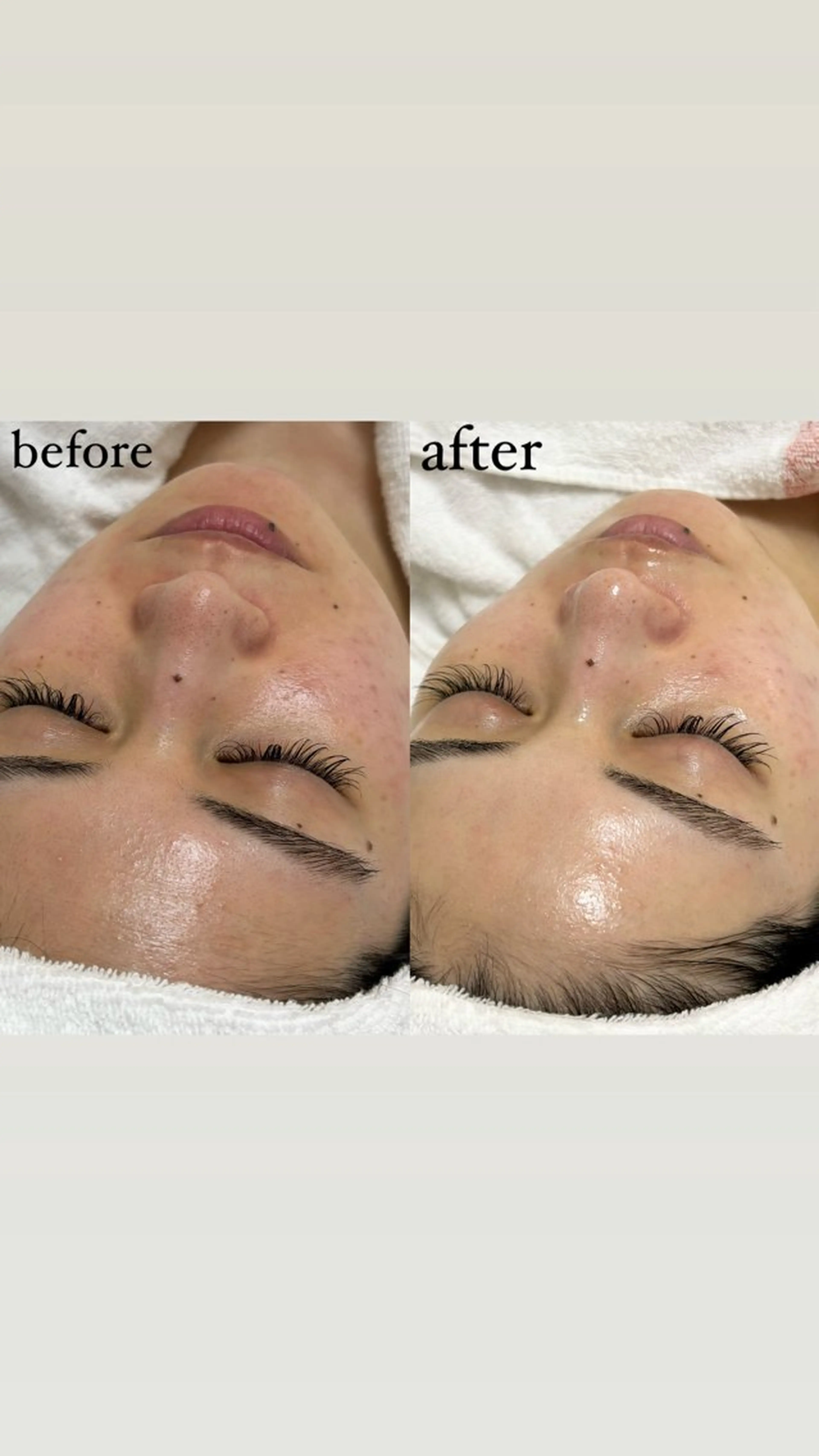 女性専門お顔剃り sunraineのエステ・リラクイメージ