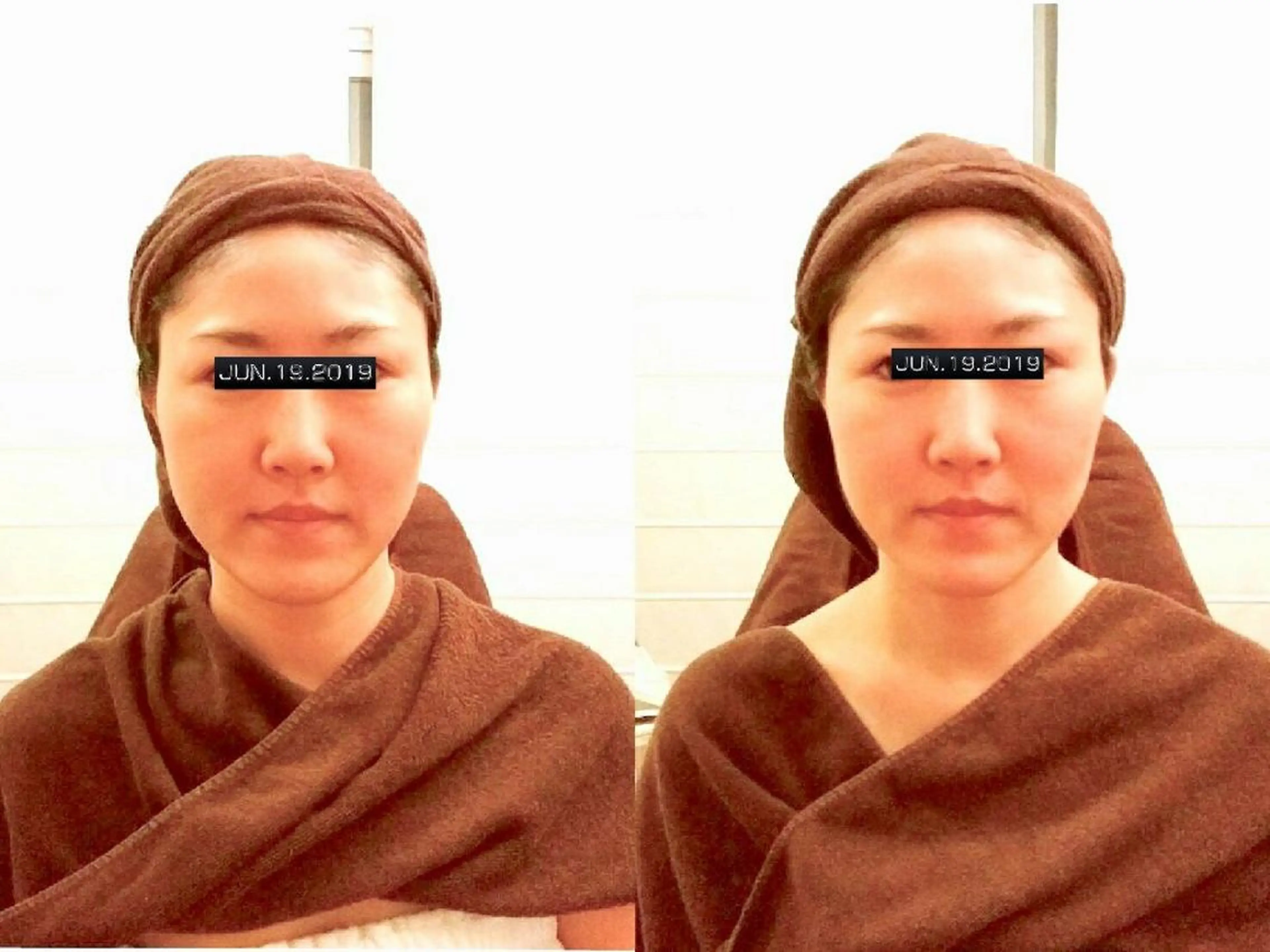 エステ machiyama kazuyoのエステ・リラクイメージ