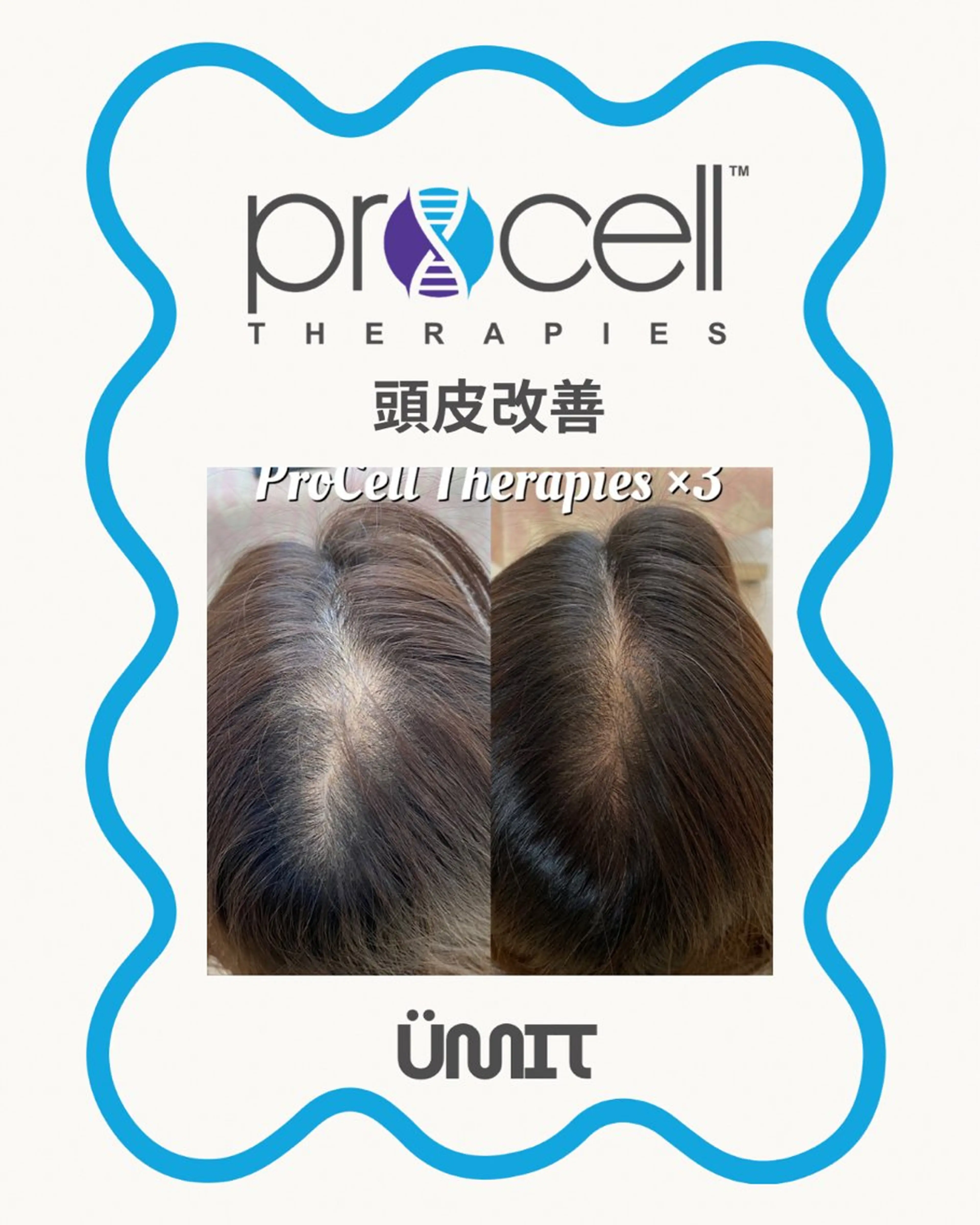 ヘッドスパ Ümit（ユミト） プロセルセラピーズのヘアスタイル