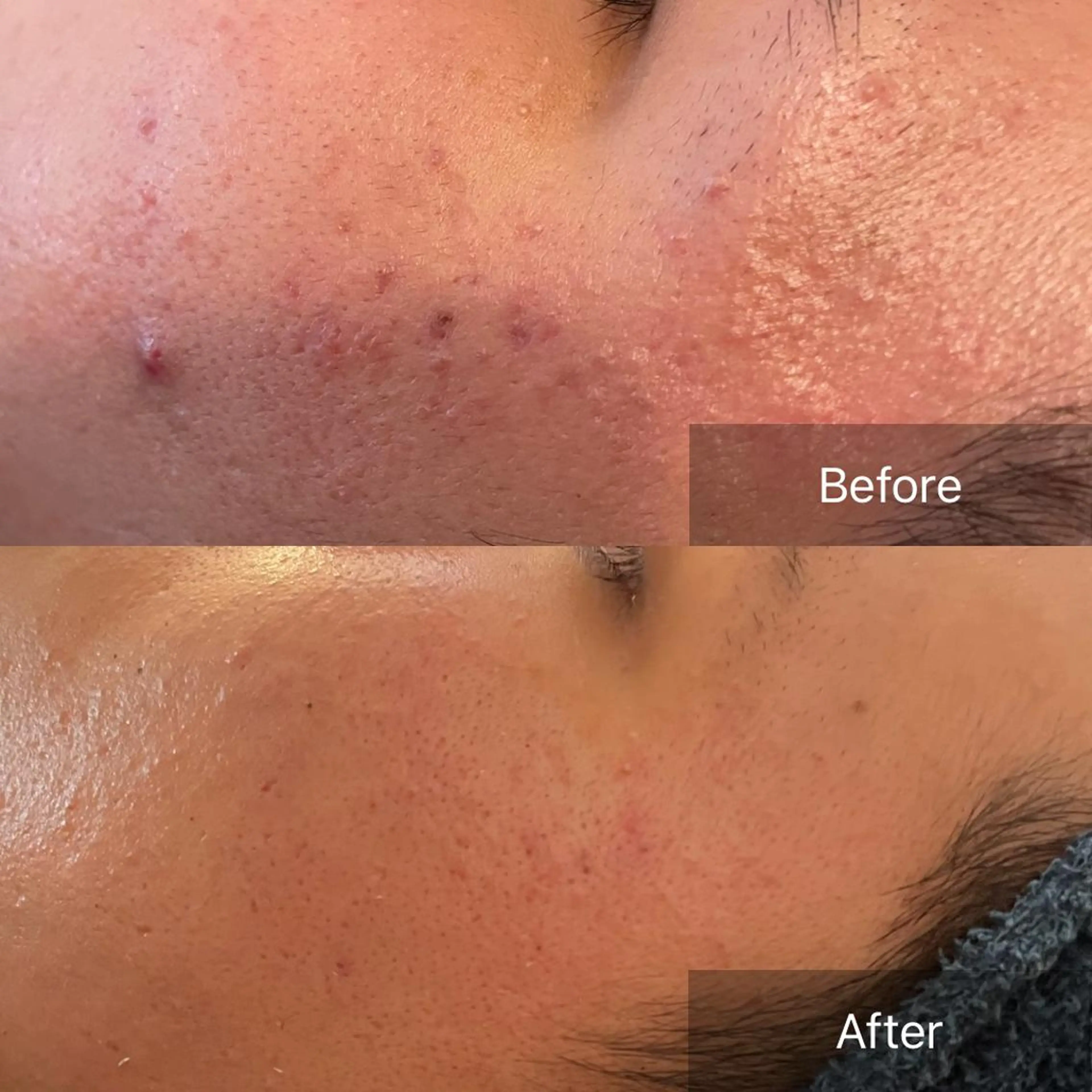 美楽鍼 びらくしんのその他イメージ