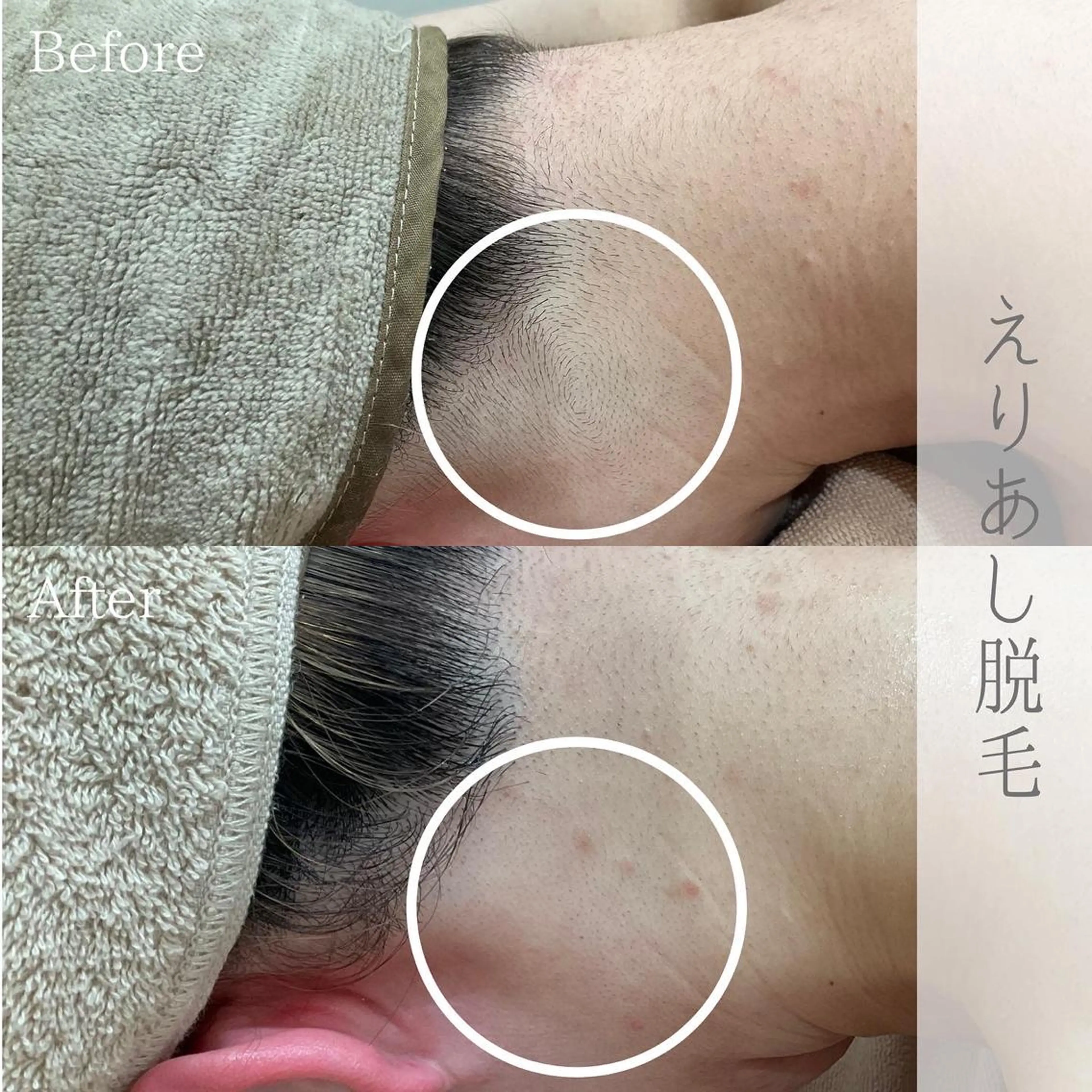 脱毛 ciena KAYOのその他イメージ