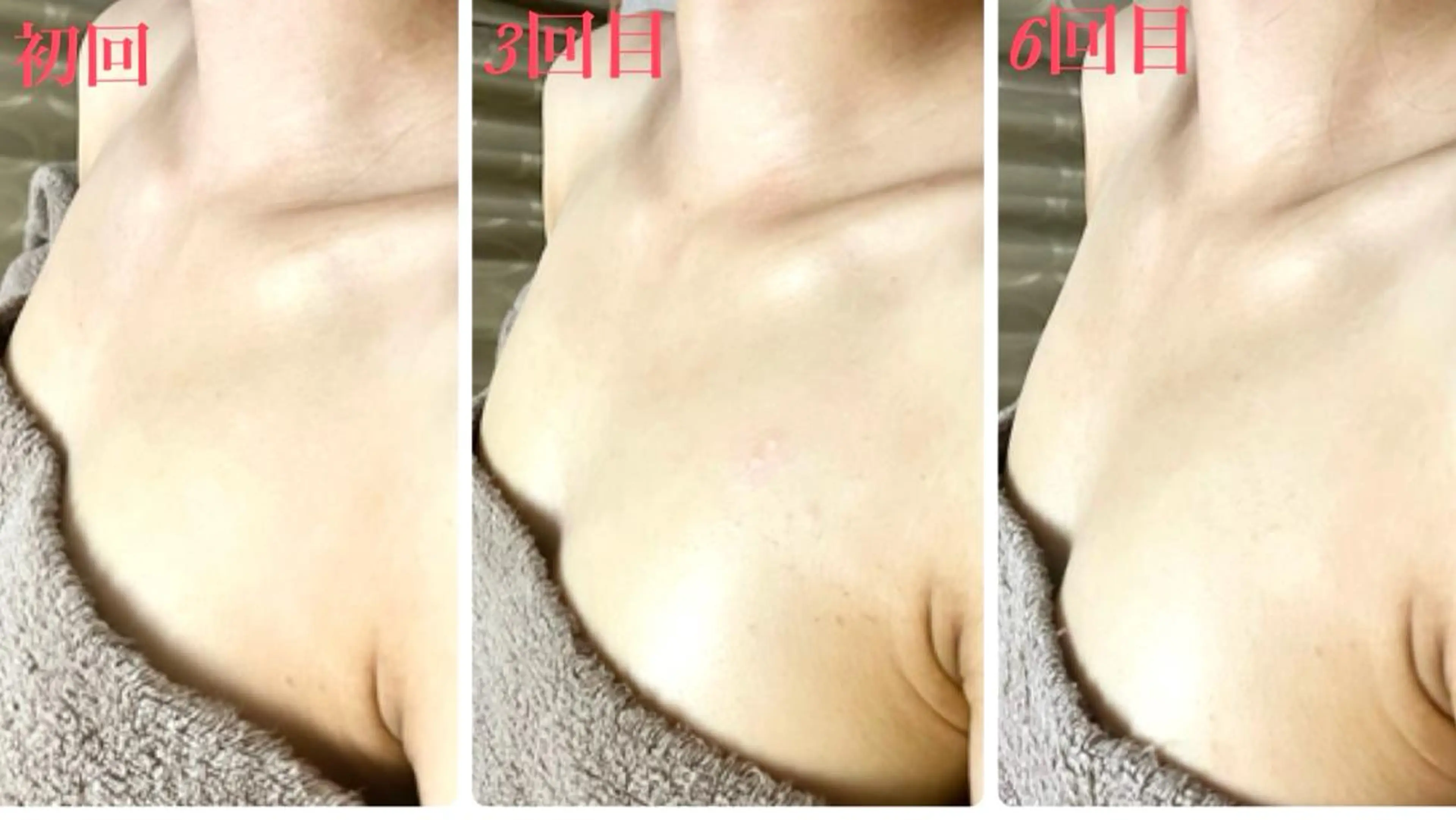 エステ リラク 美ola ビオラのエステ・リラクイメージ