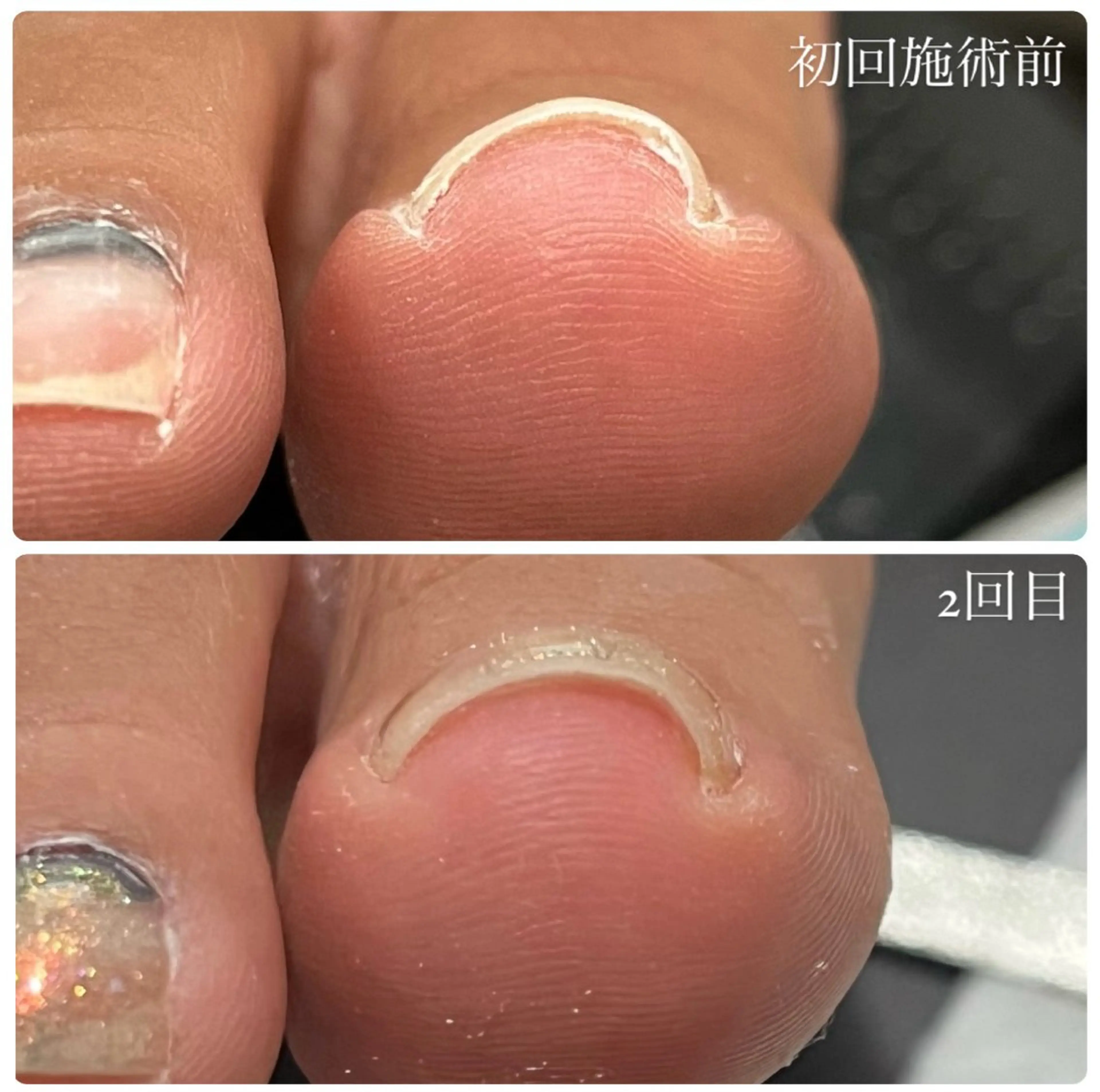 ネイル ジェルネイル フットネイル kupu所属・ネイルサロン kupuのネイルデザイン