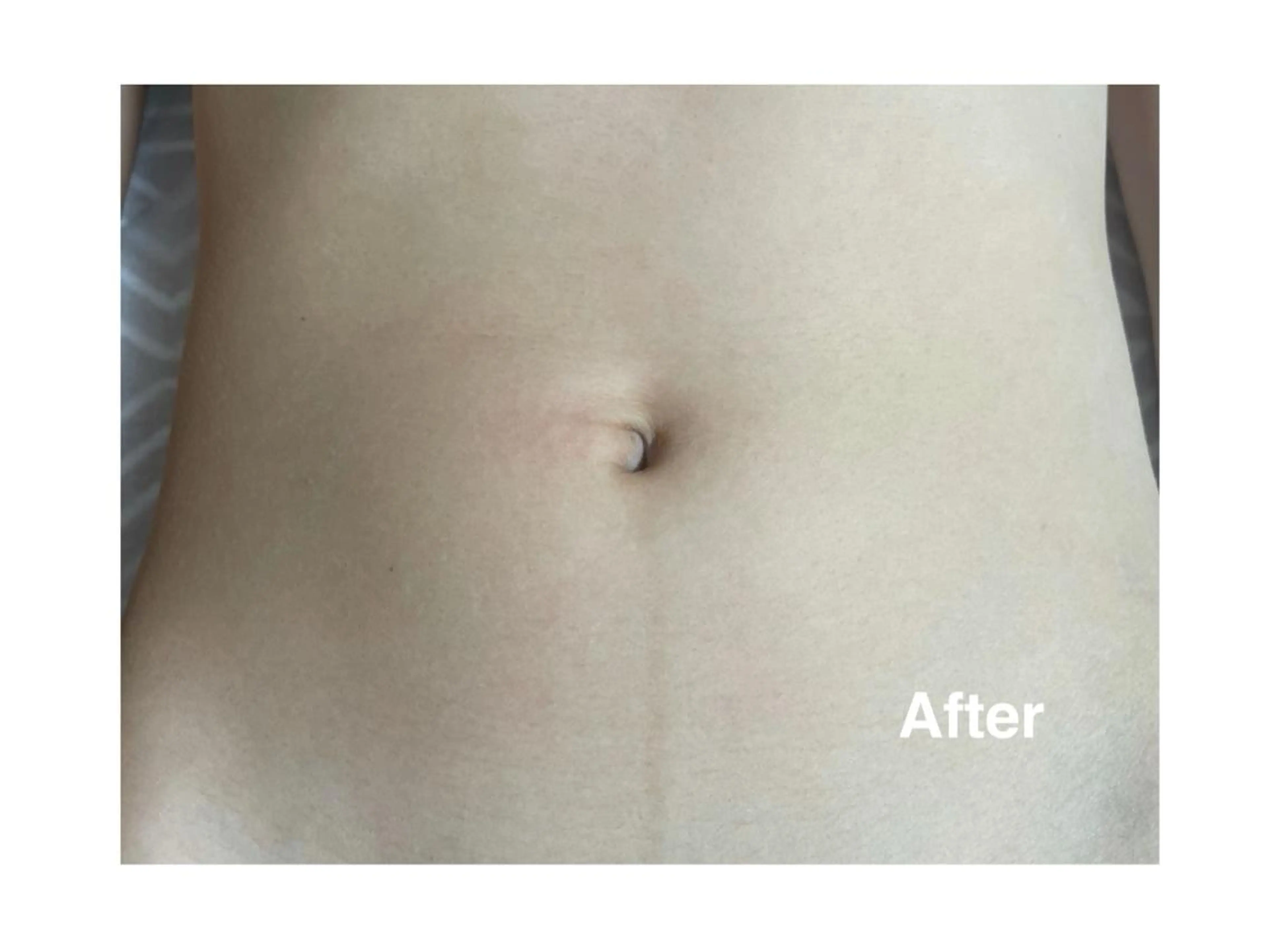 地上のトレチカ sugaringのエステ・リラクイメージ