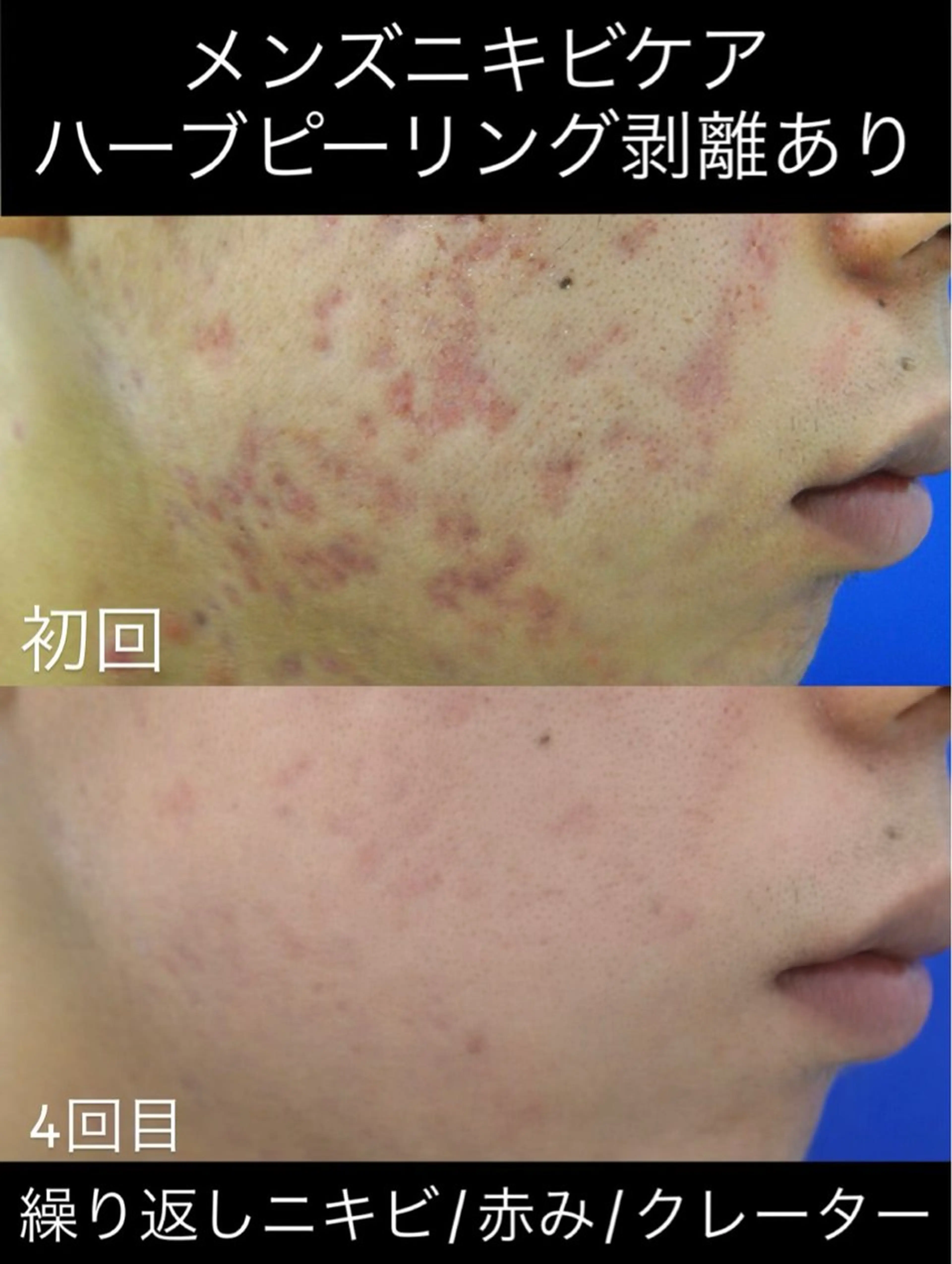 エステ Soin所属・Soin 身体＆お肌ケアのエステ・リラクイメージ