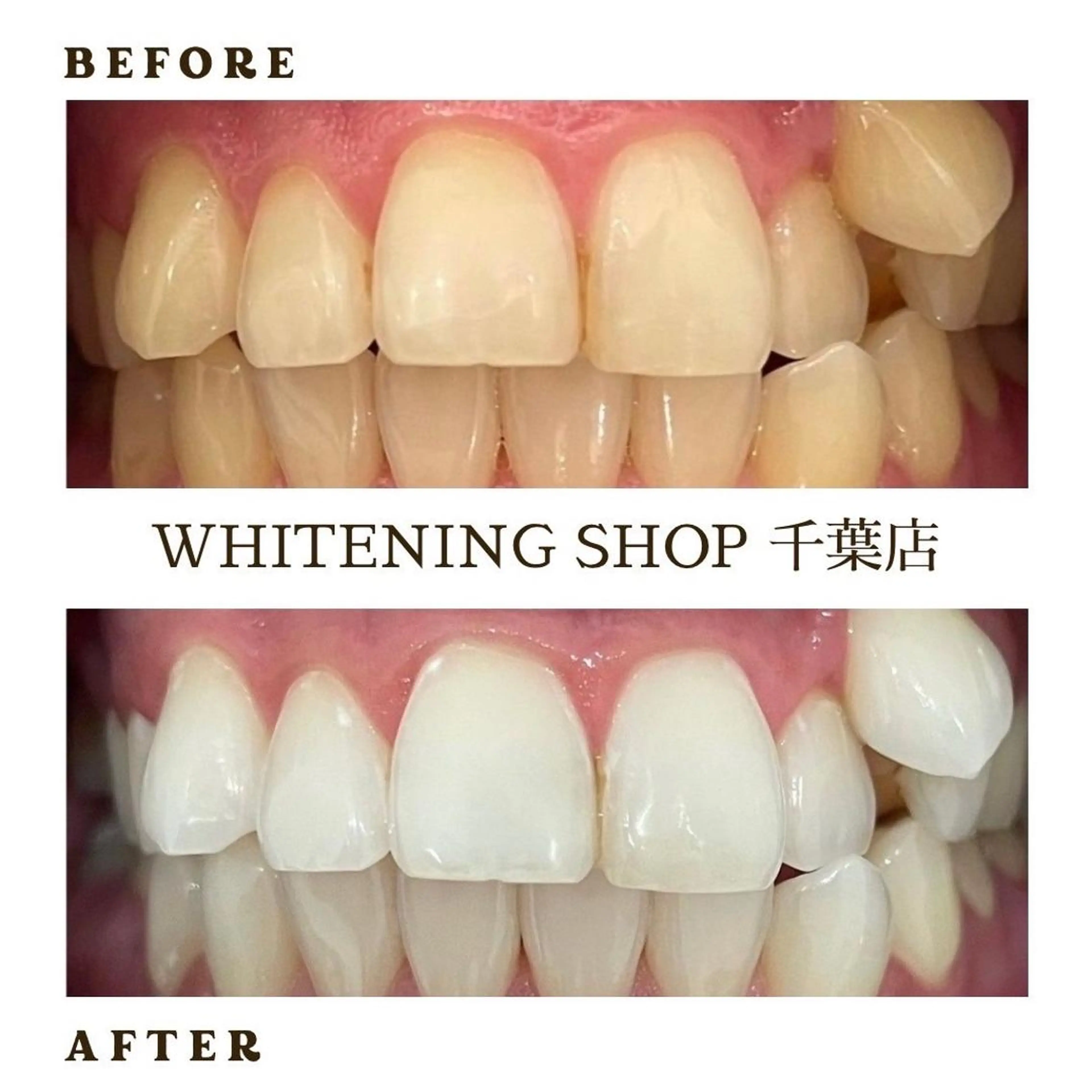 メンズ その他 ホワイトニング ショップ千葉店のその他イメージ