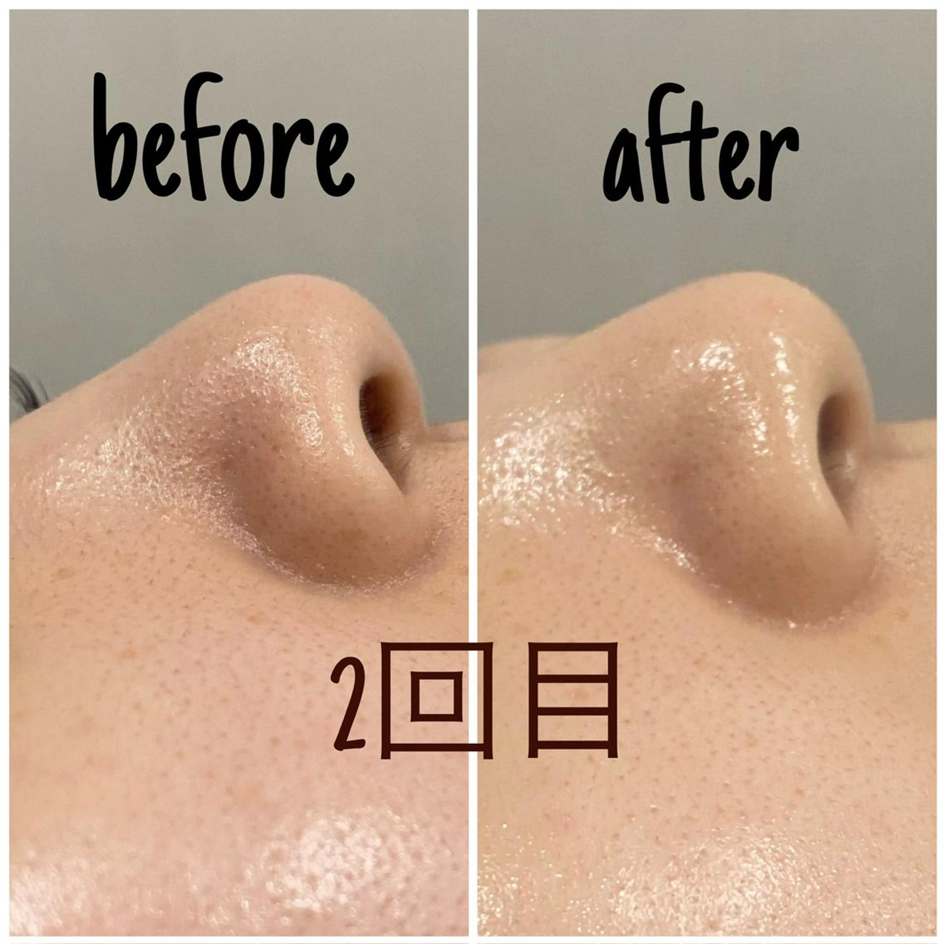 アルカンジュ~archange~所属・痩身/毛穴洗浄/脱毛 アルカンジュのエステ・リラクイメージ