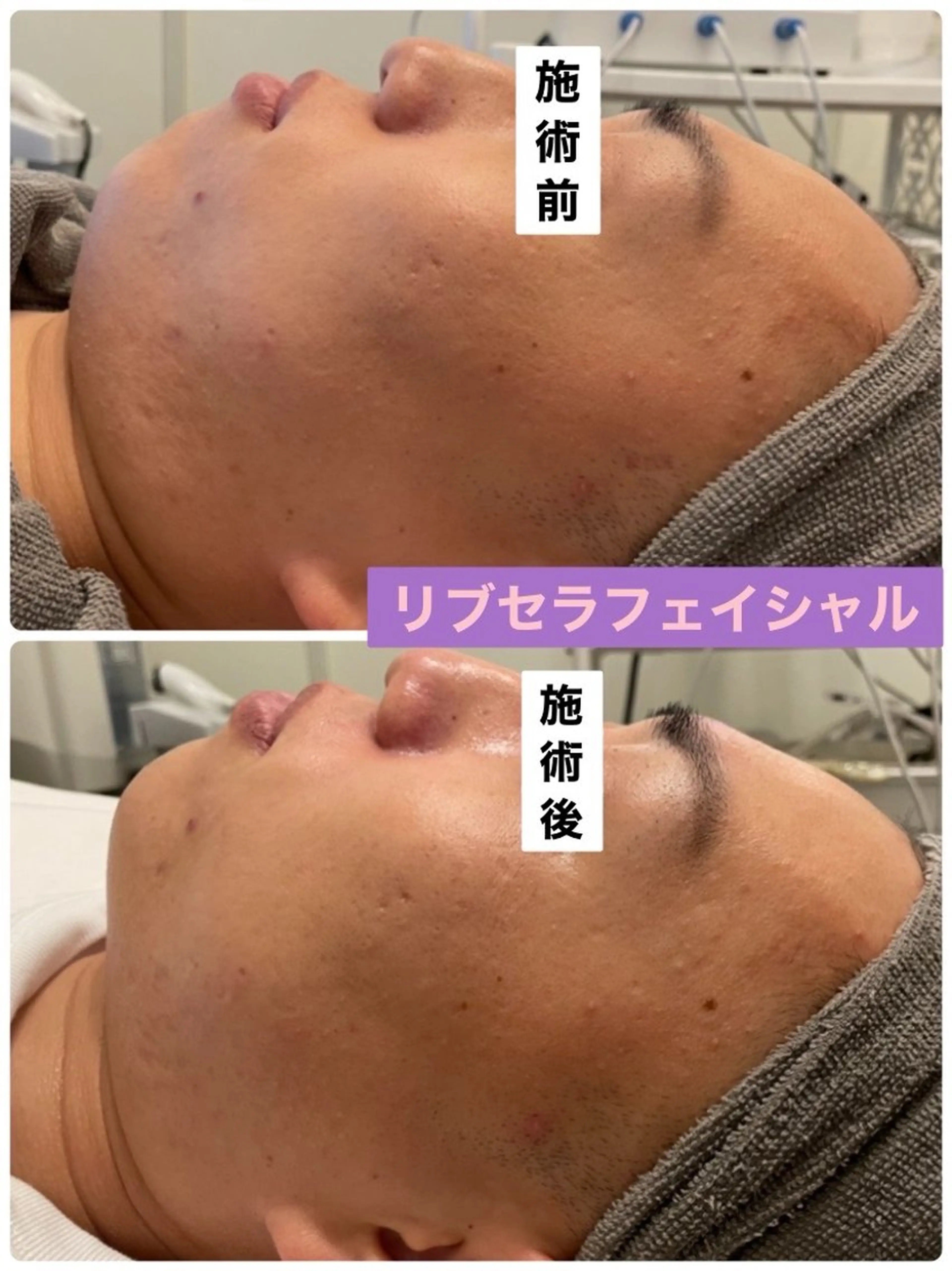 メンズ Private Salon Prunelle所属・プライベートサロン プリュネルのエステ・リラクイメージ