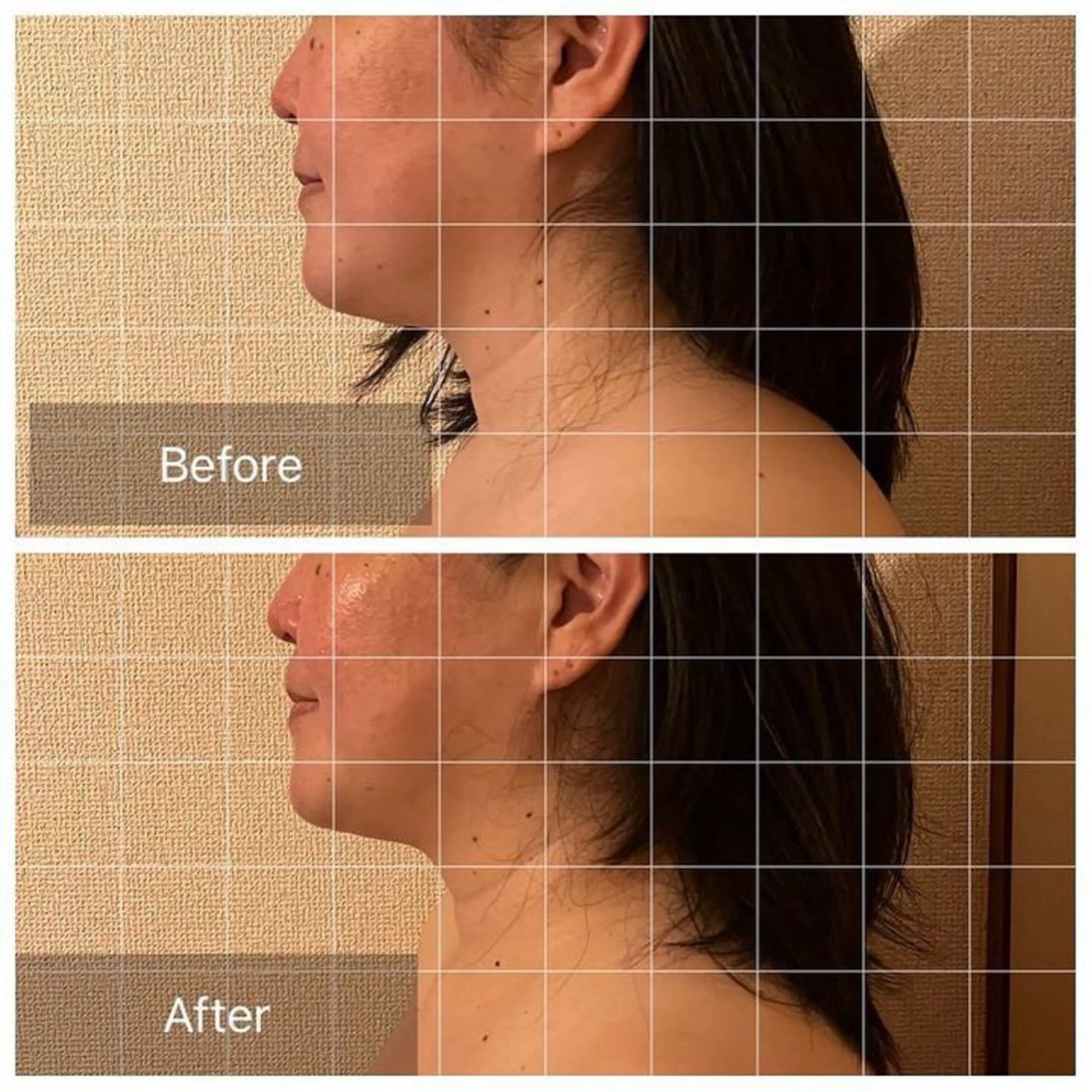 エステ リラク 表情筋フェイシャル 三軒茶屋のエステ・リラクイメージ