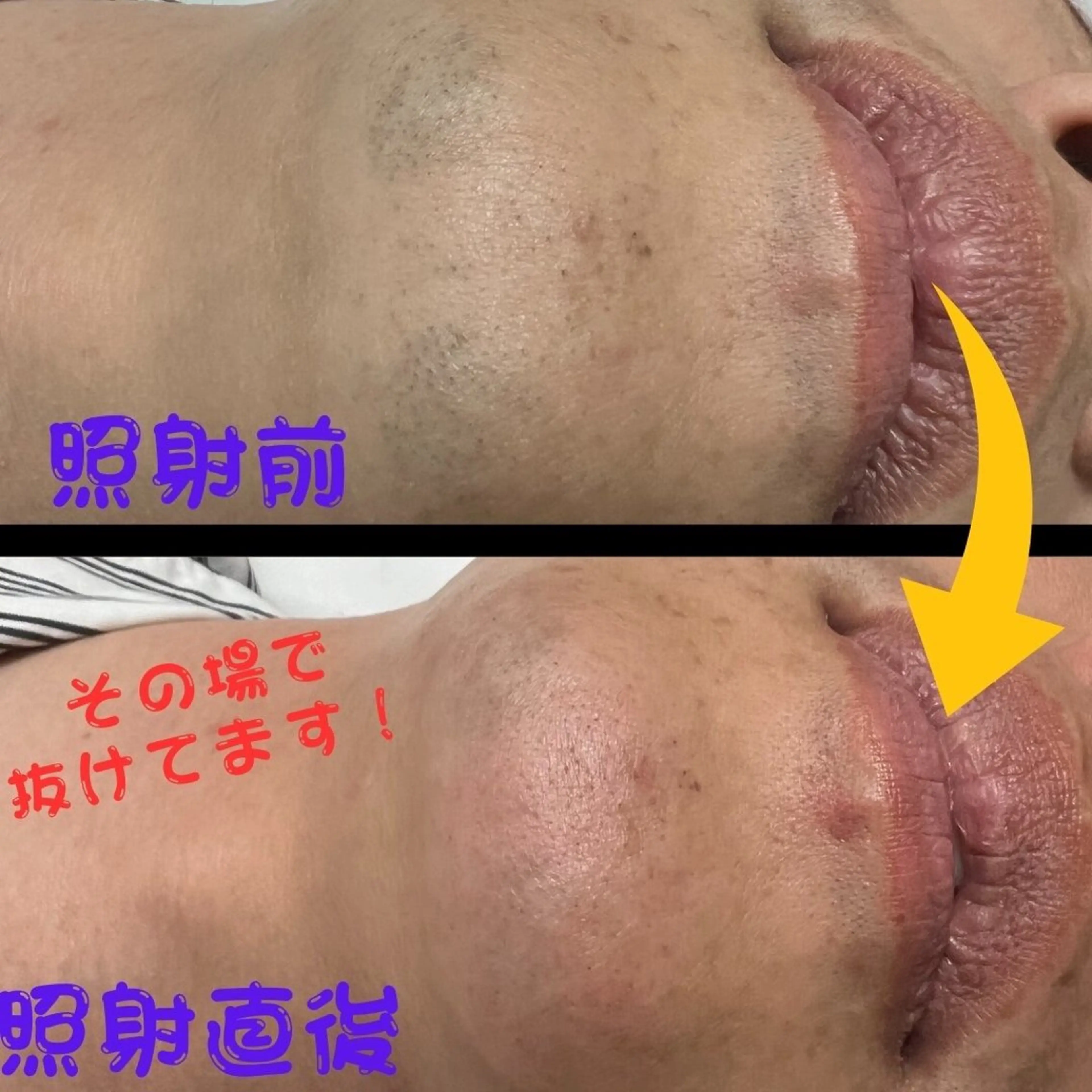 メンズ キッズ 脱毛 メンズ脱毛　FELISSE【フェリッセ】所属・メンズ脱毛フェリッセ /男女🆗キッズ🆗のエステ・リラクイメージ