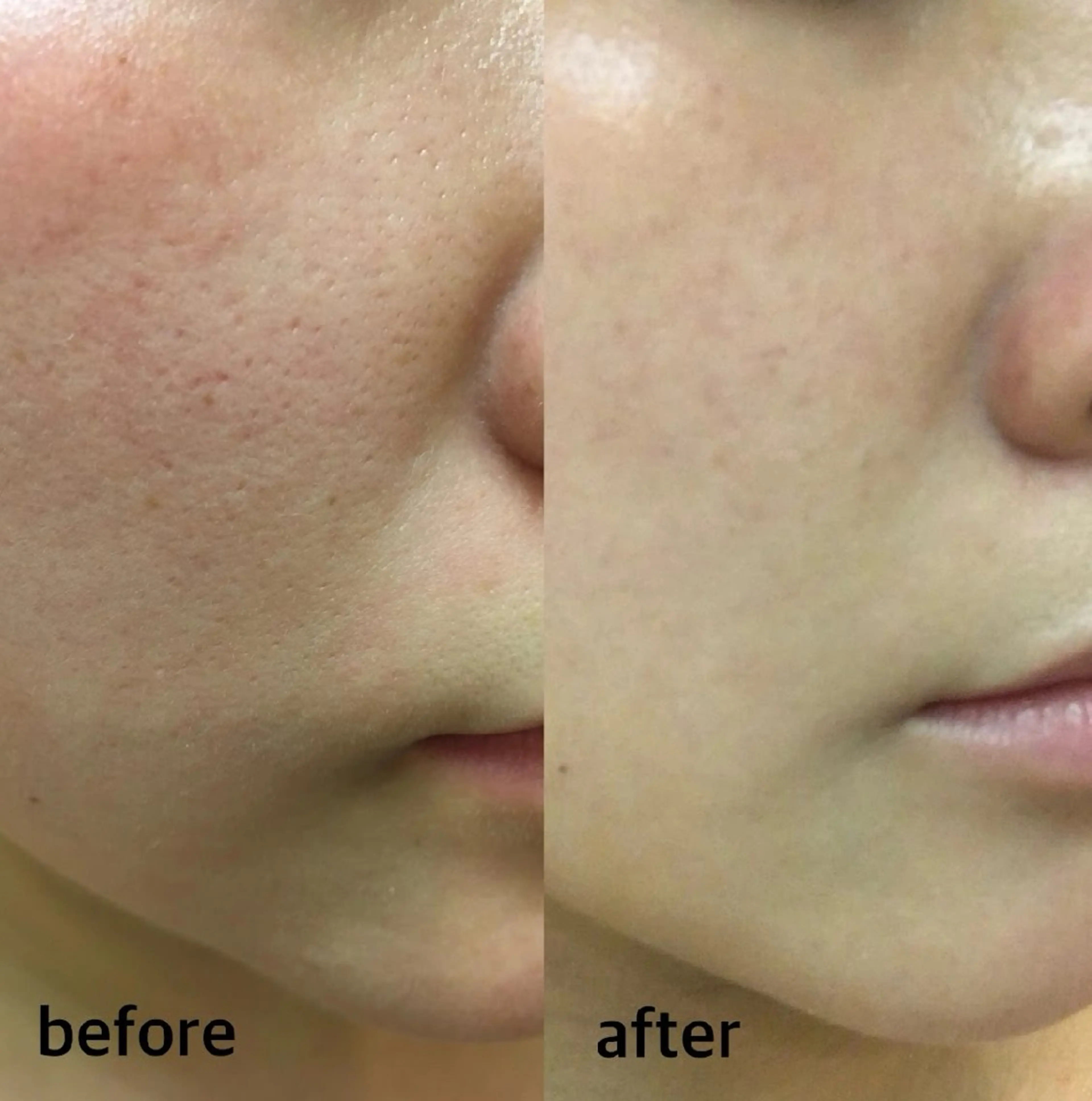 韓国肌管理Cocoh ハーブピーリングのエステ・リラクイメージ