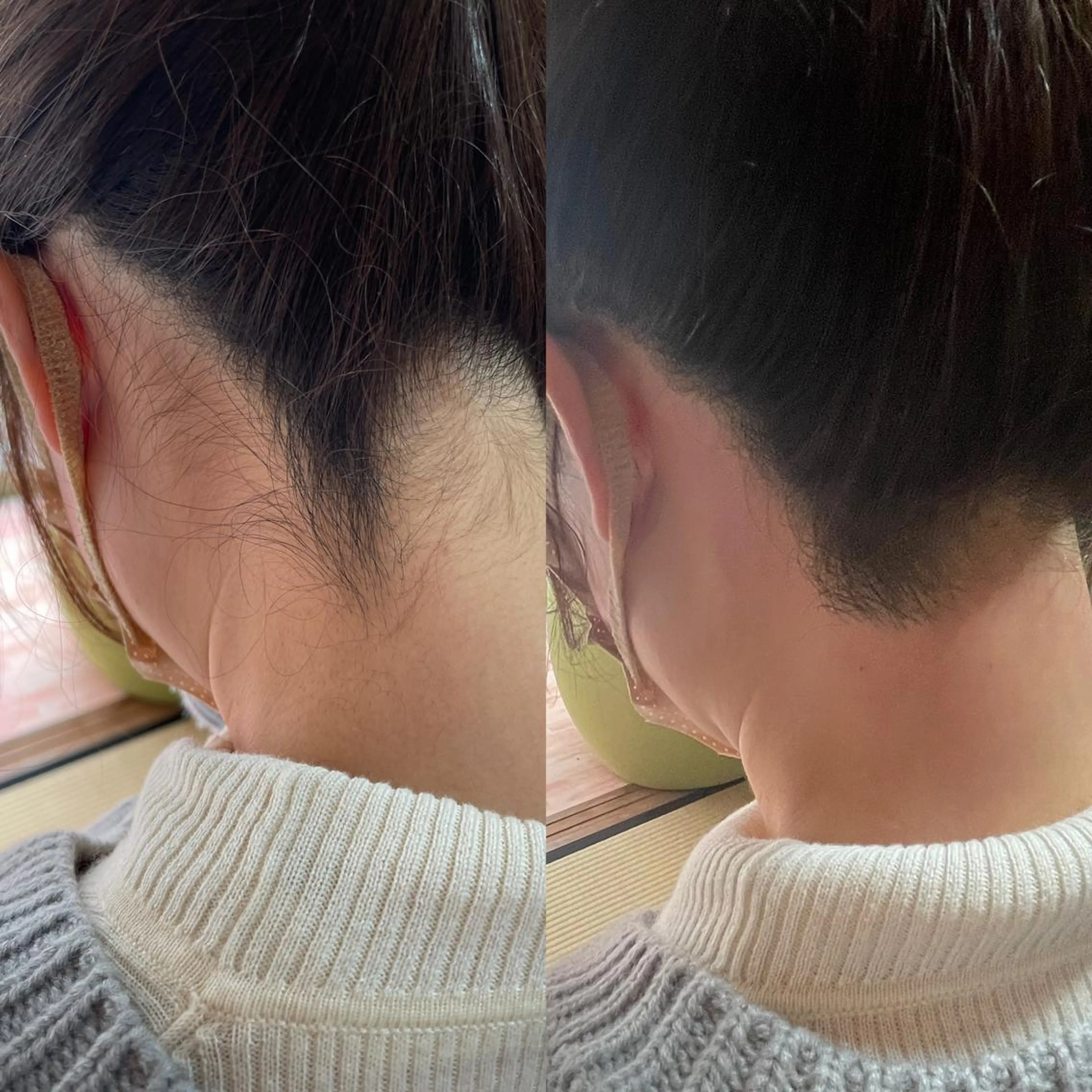 脱毛 salon HACHI♾のマツエク・マツパデザイン