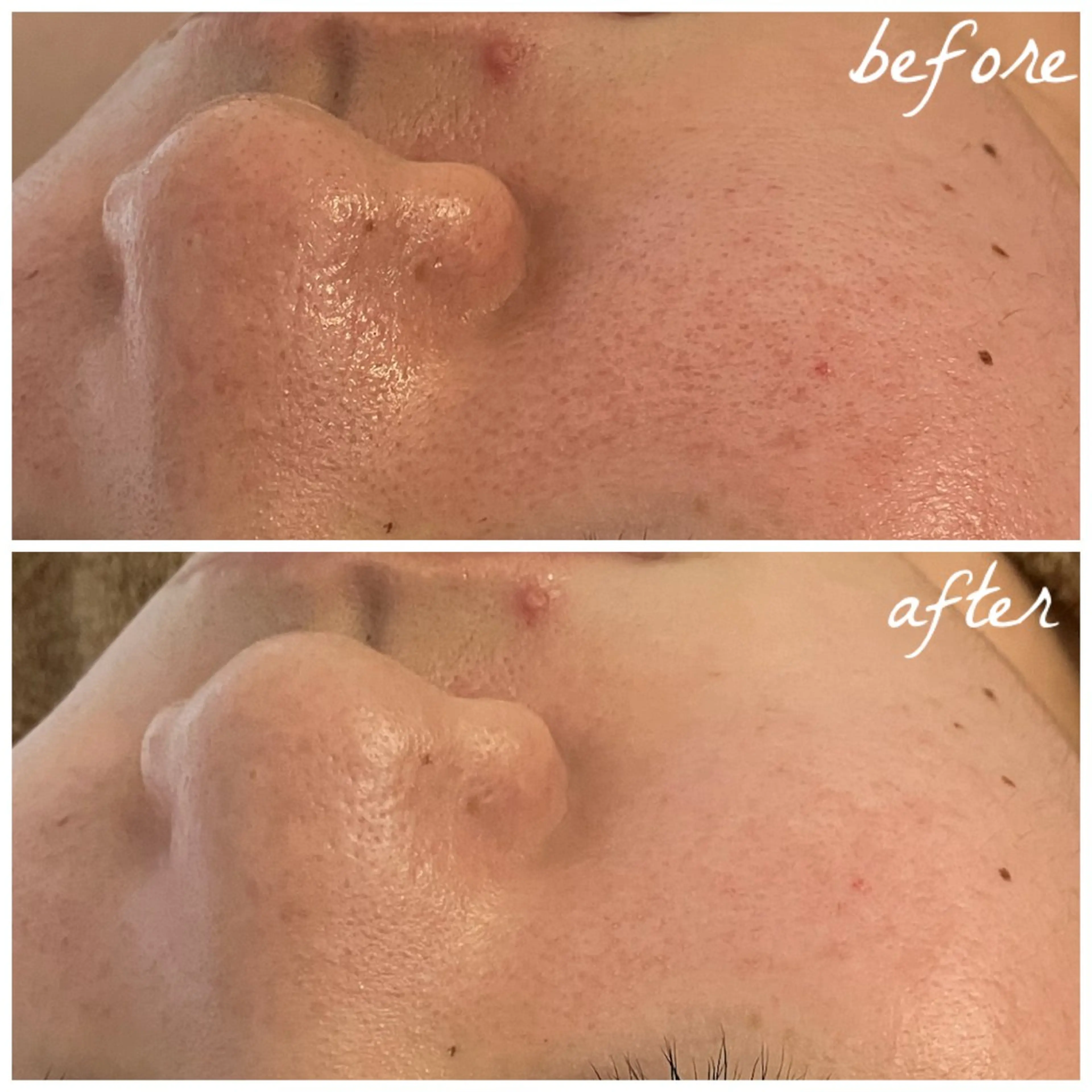 メンズ エステ メナード岐阜茜部 杉浦のエステ・リラクイメージ