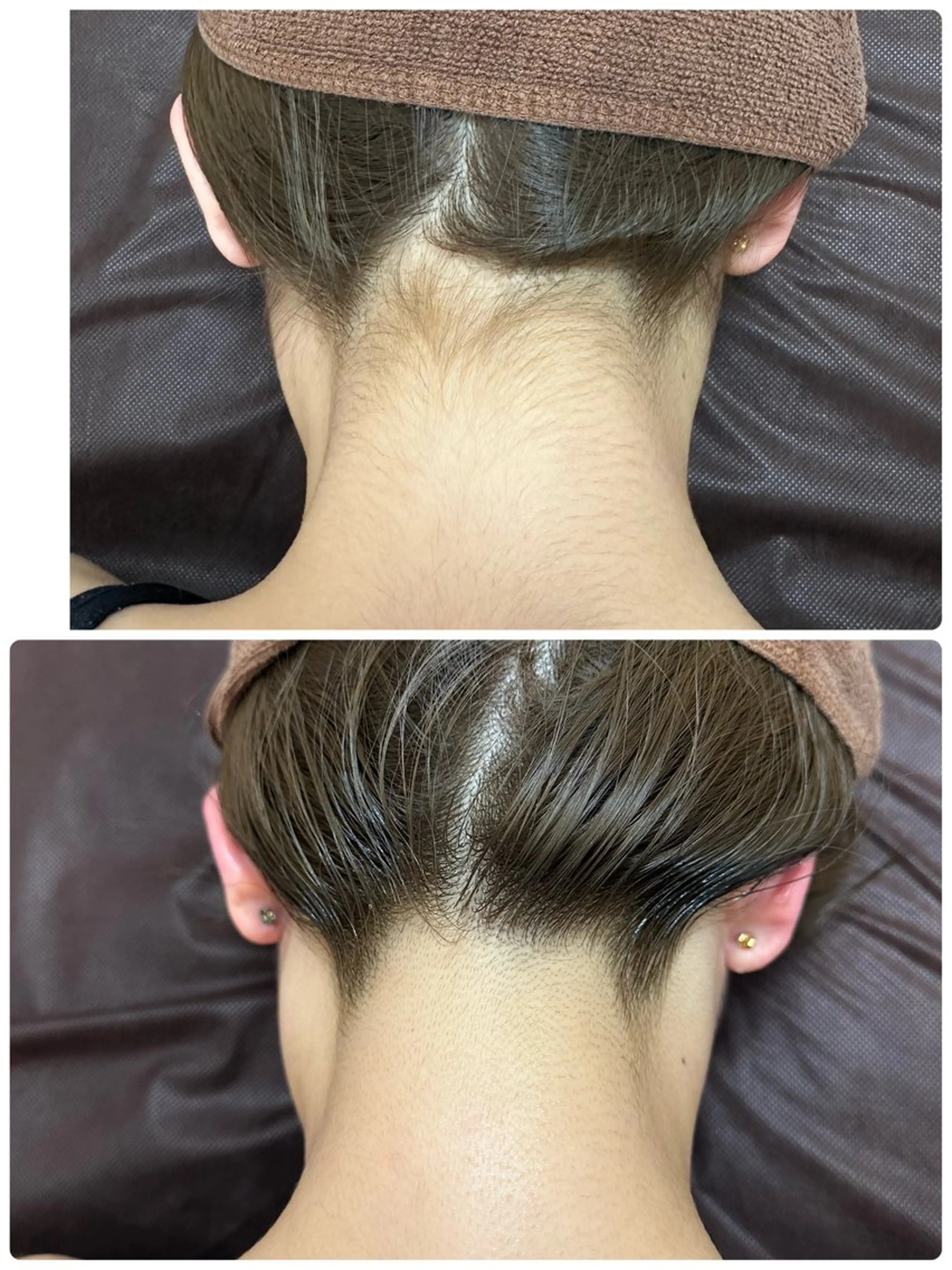 脱毛 桐山 まどかのエステ・リラクイメージ