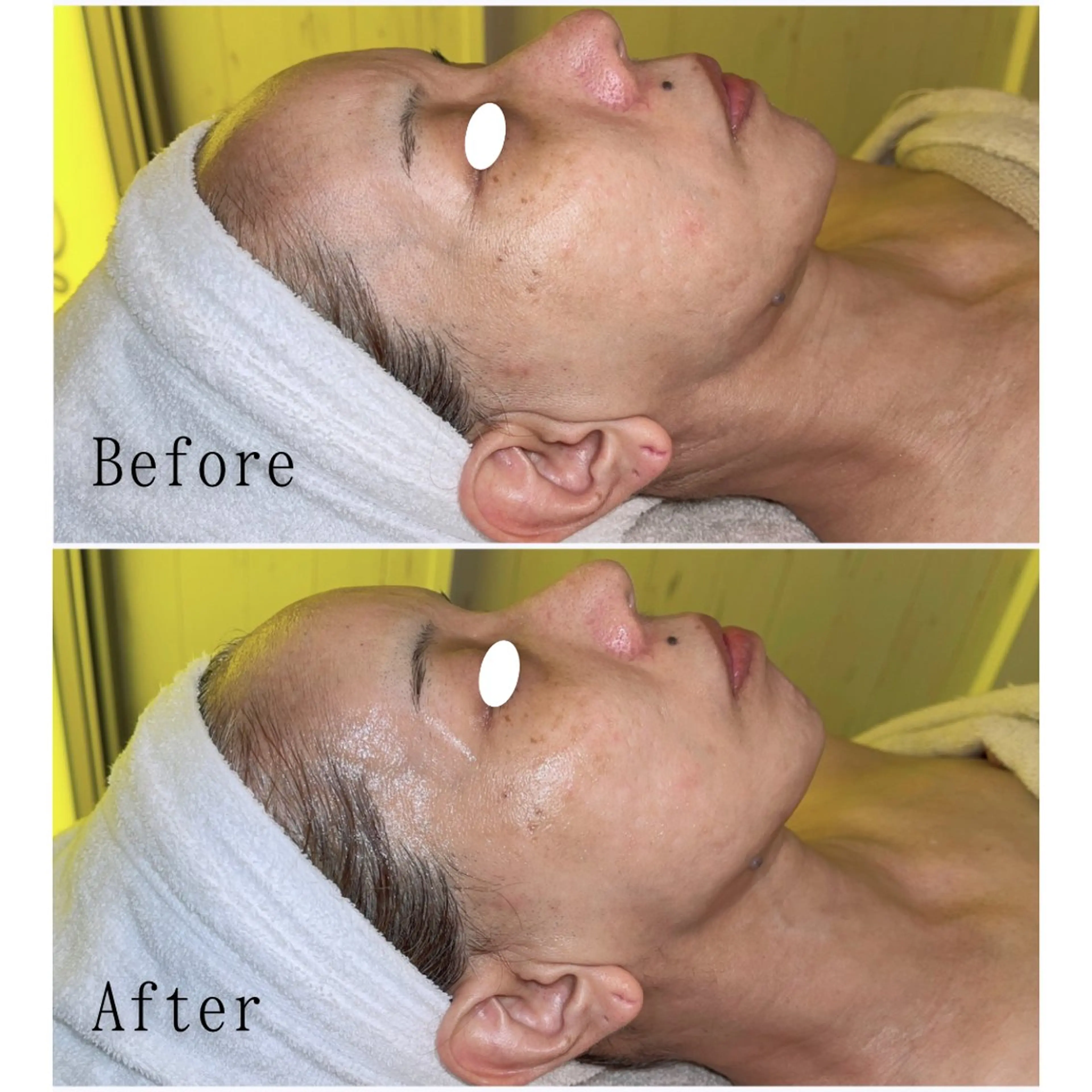 エステ SELF  BEAUTY gracia浦添店所属・gracia 浦添店のその他イメージ