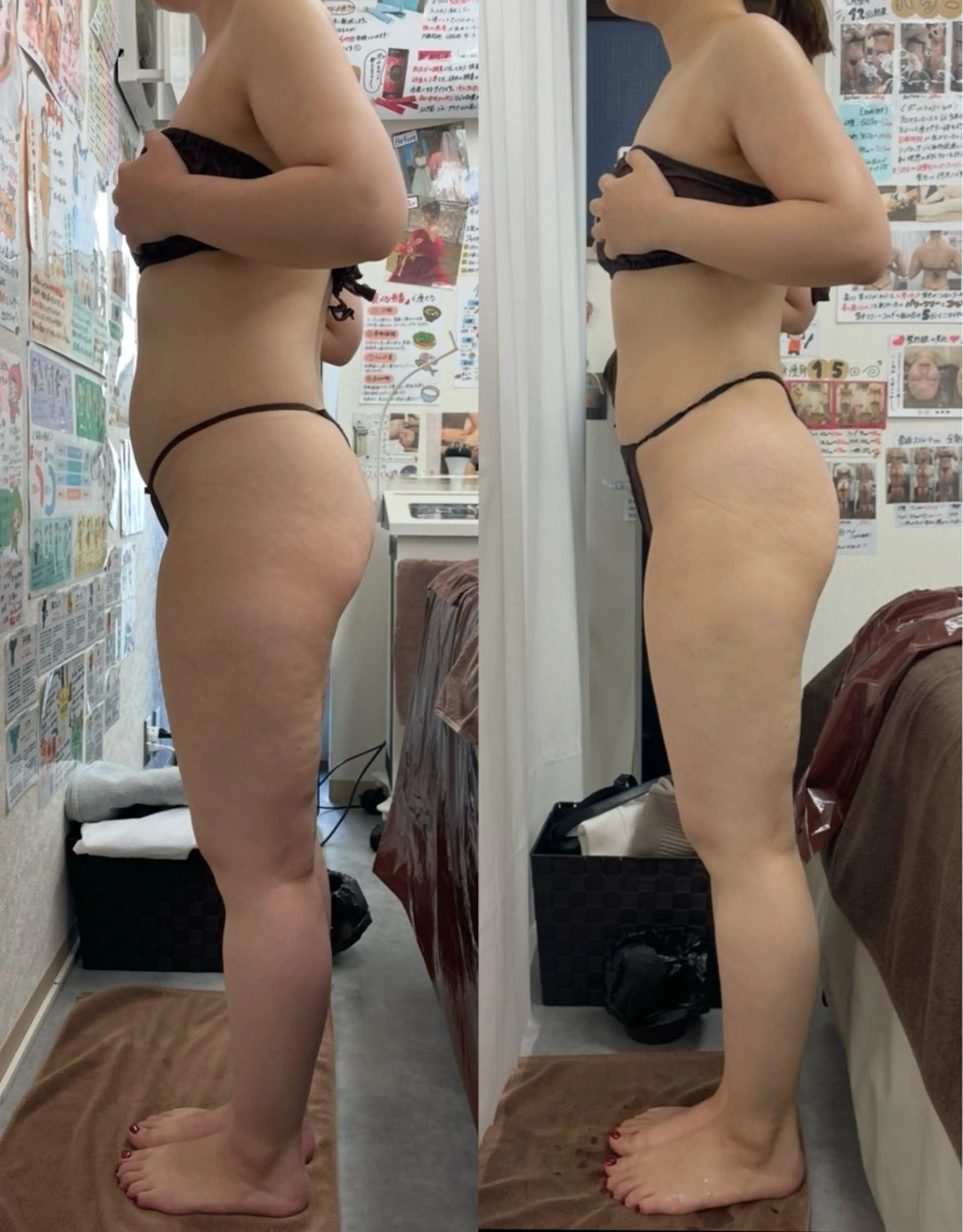 エステ リラク espresso,所属・《痩身、小顔専門店》 エスプレッソのエステ・リラクイメージ