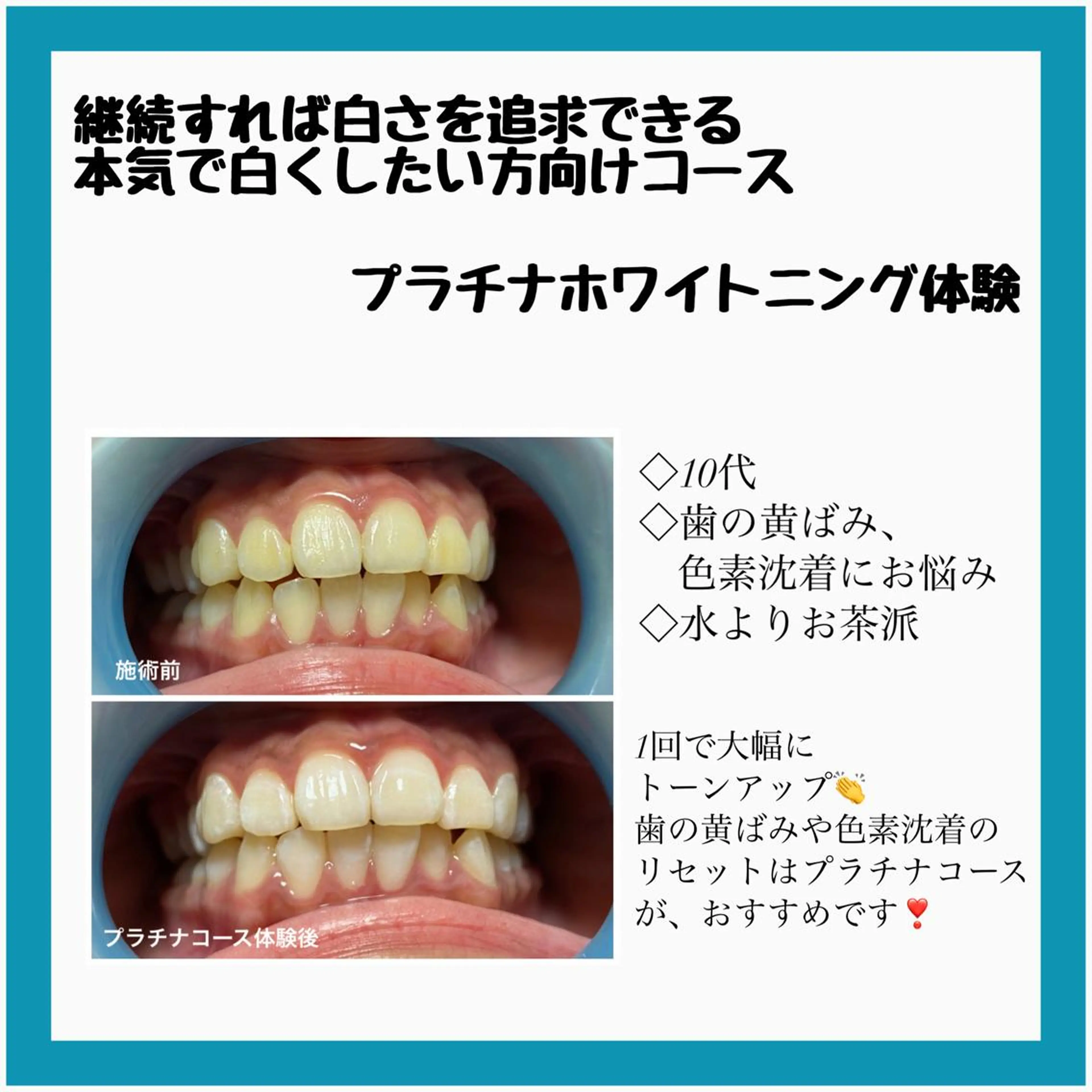 ネイル/耳つぼ /新ホワイトニングのネイルデザイン