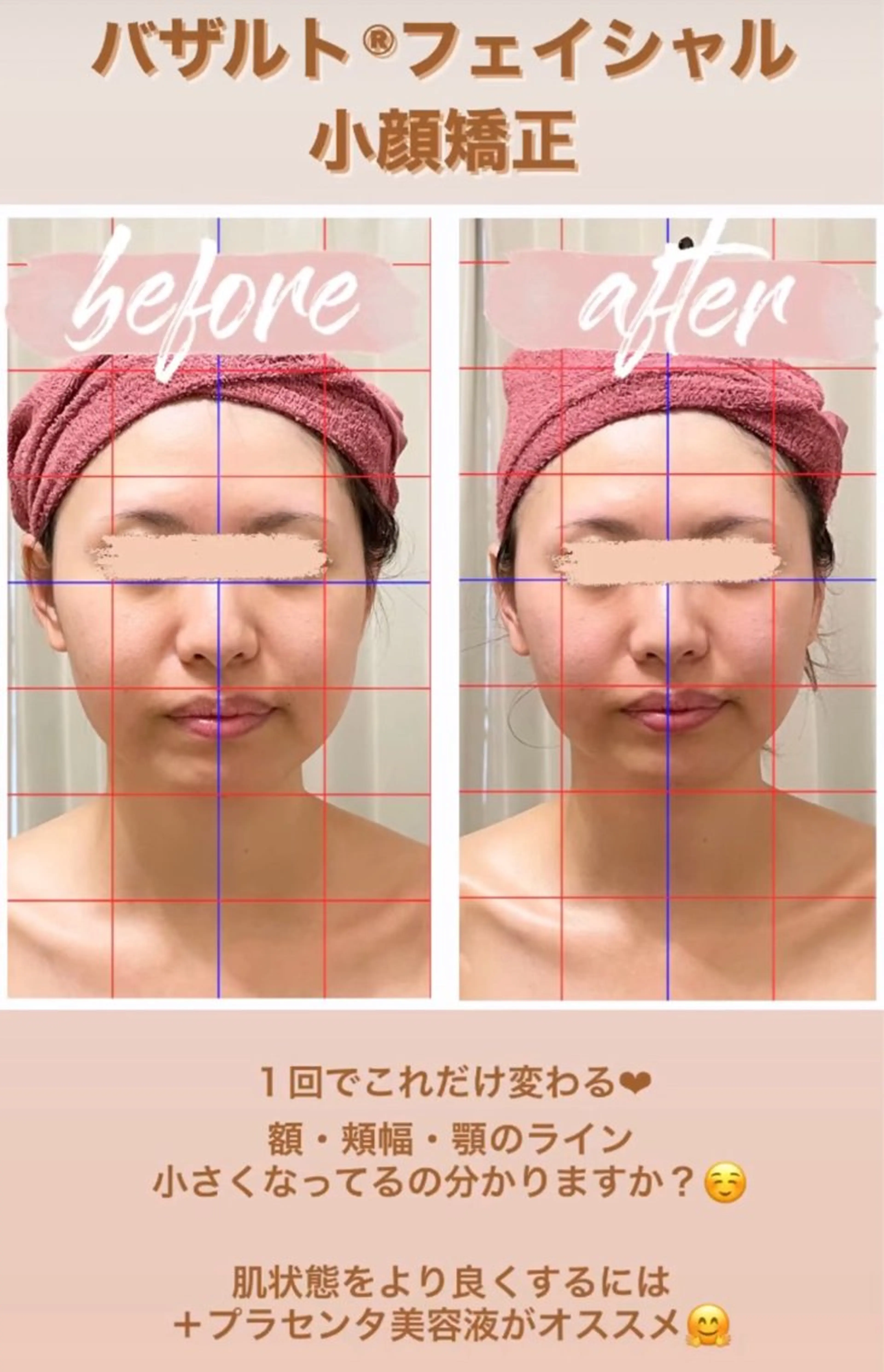 エステ 糸島 エステサロンmiuのエステ・リラクイメージ