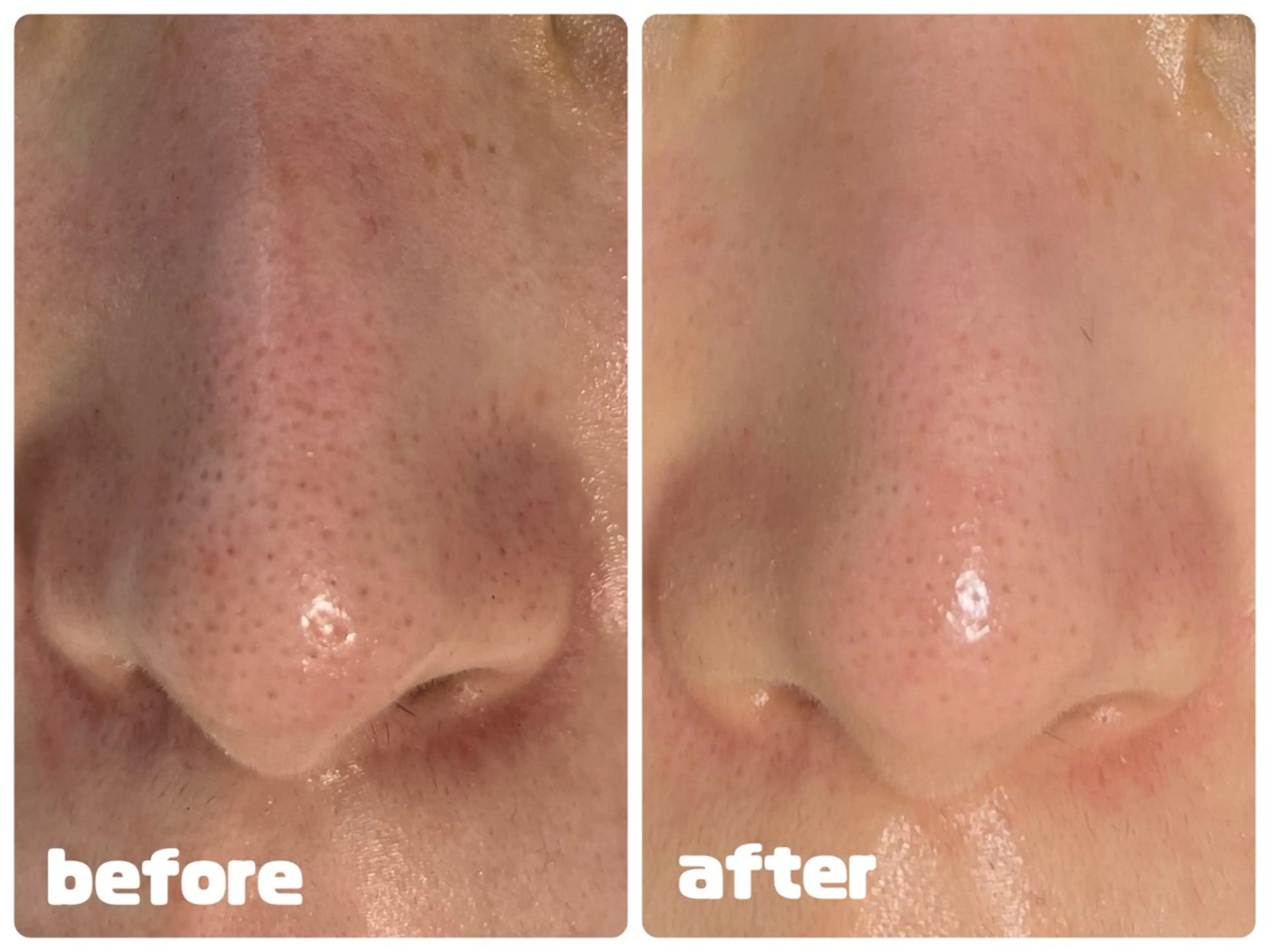 エステ SALON MAREのネイルデザイン