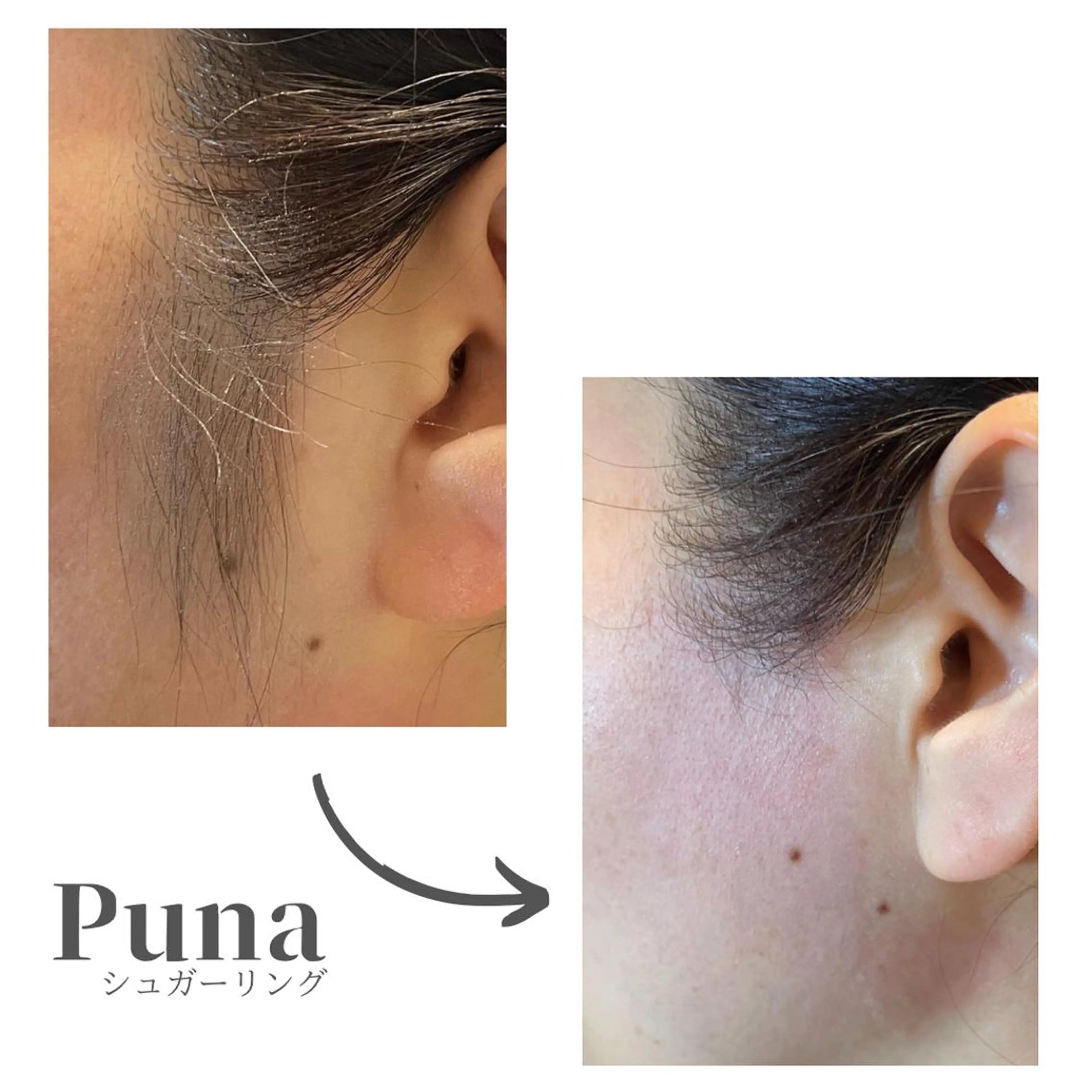 ぷーな シュガーリング竹ノ塚のエステ・リラクイメージ