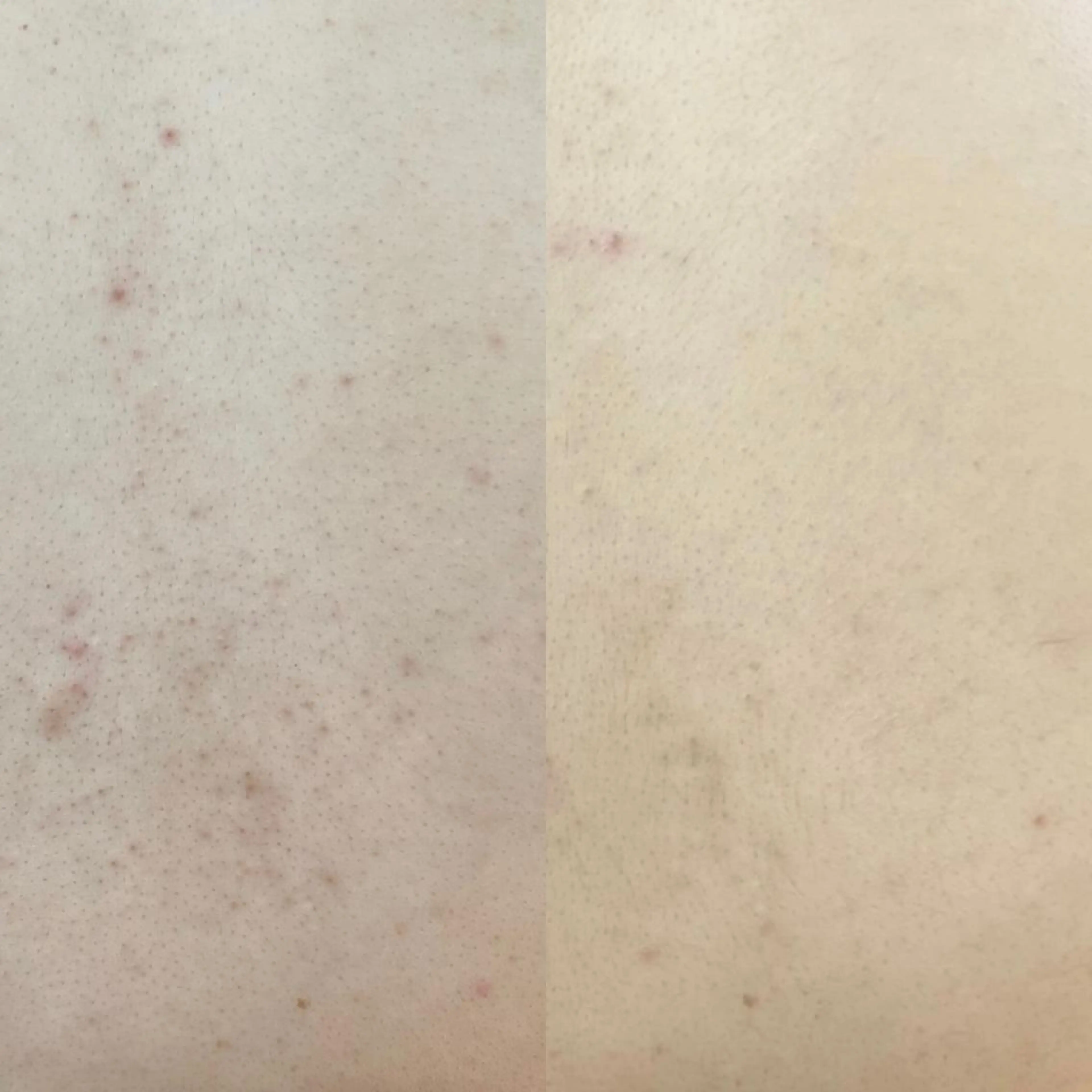 エステ Beauty Salon Ciel　Chiba所属・BeautySalo nCielChibaのエステ・リラクイメージ