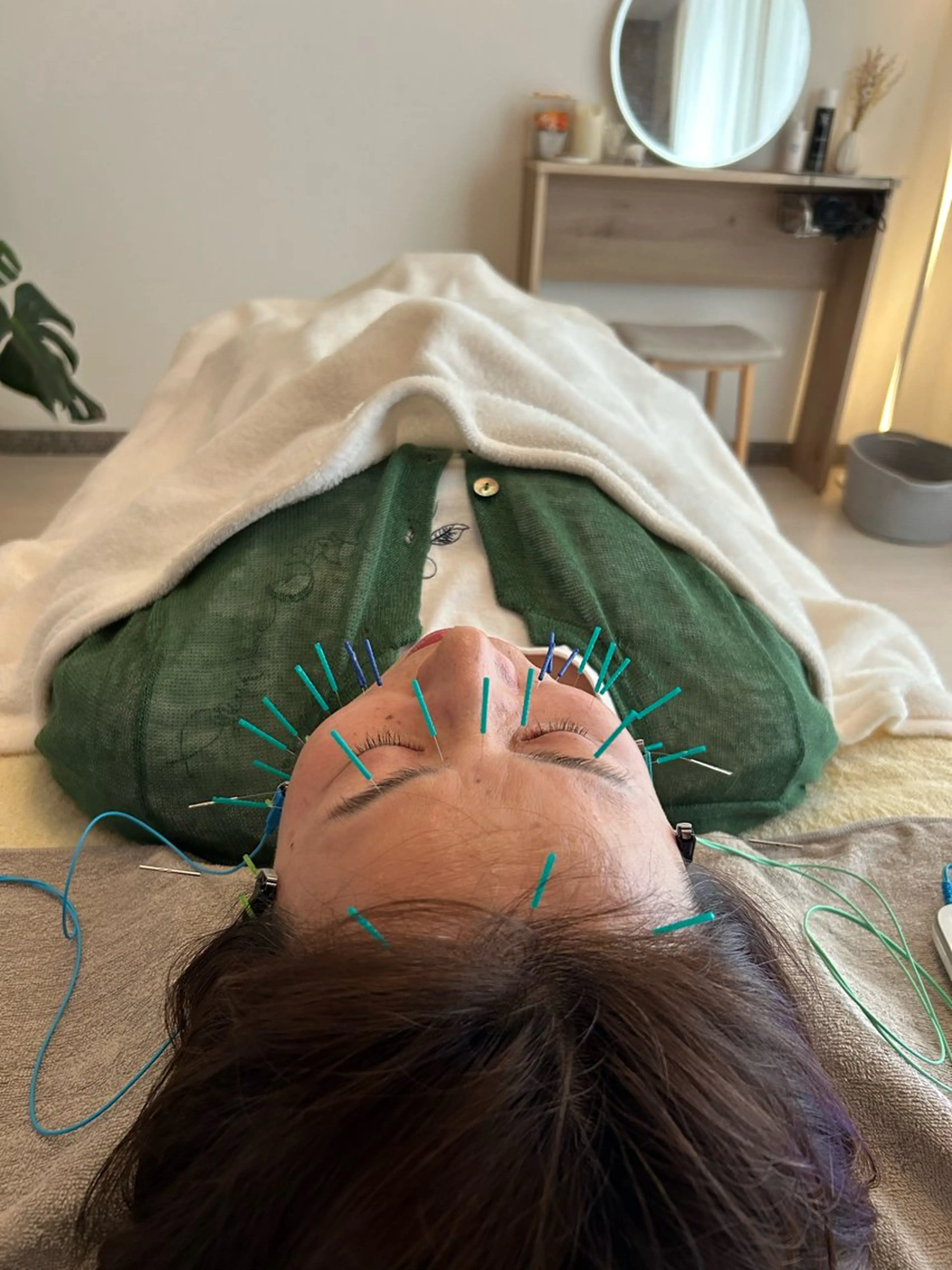 エステ リラク 鍼灸•マッサージサロンCalfa所属・《美肌･小顔》美容鍼 ＆マッサージ＊MEIのエステ・リラクイメージ