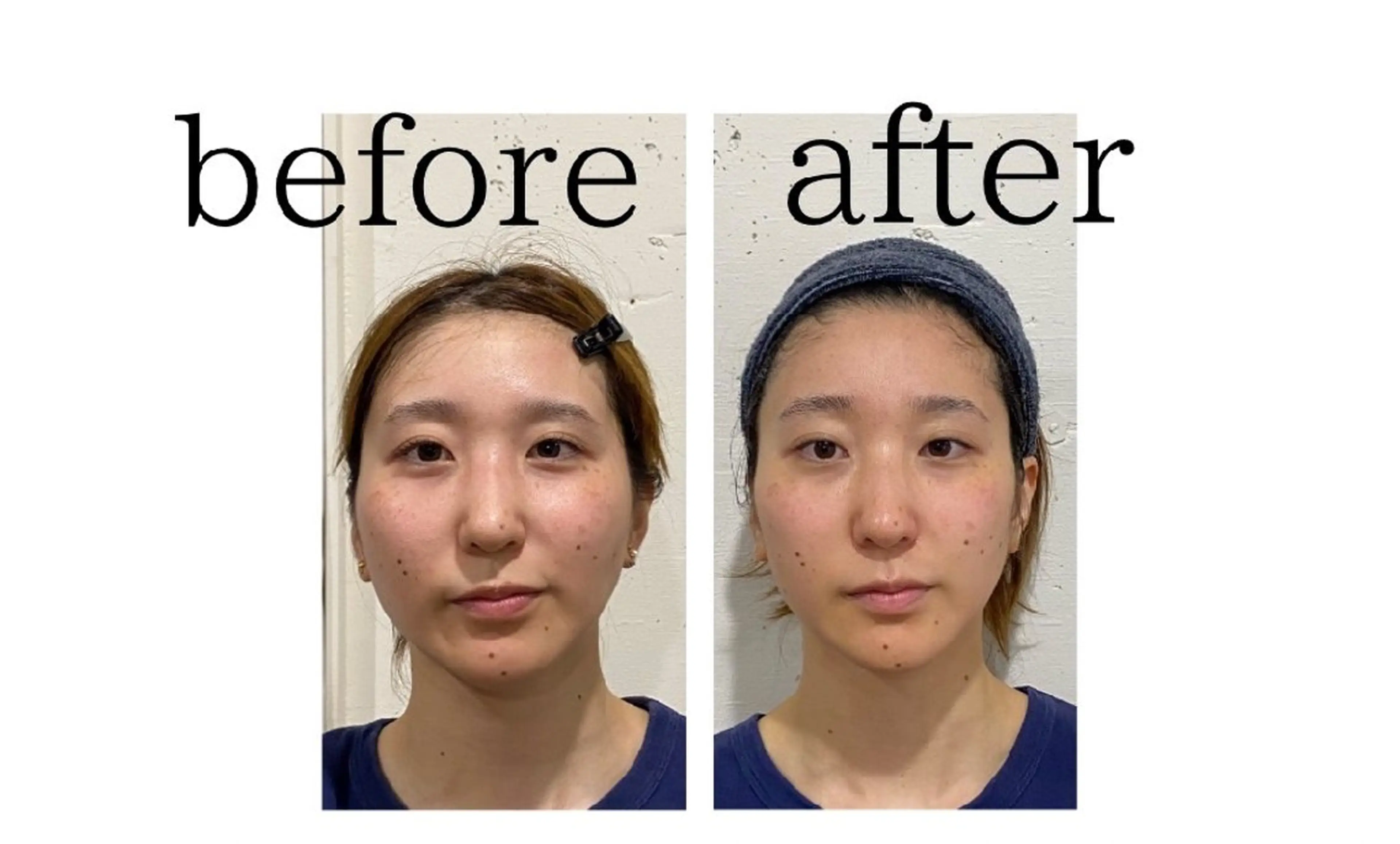 肩こり・まき肩をなくして！小顔へ【小顔矯正＋肩甲骨はがし】の写真