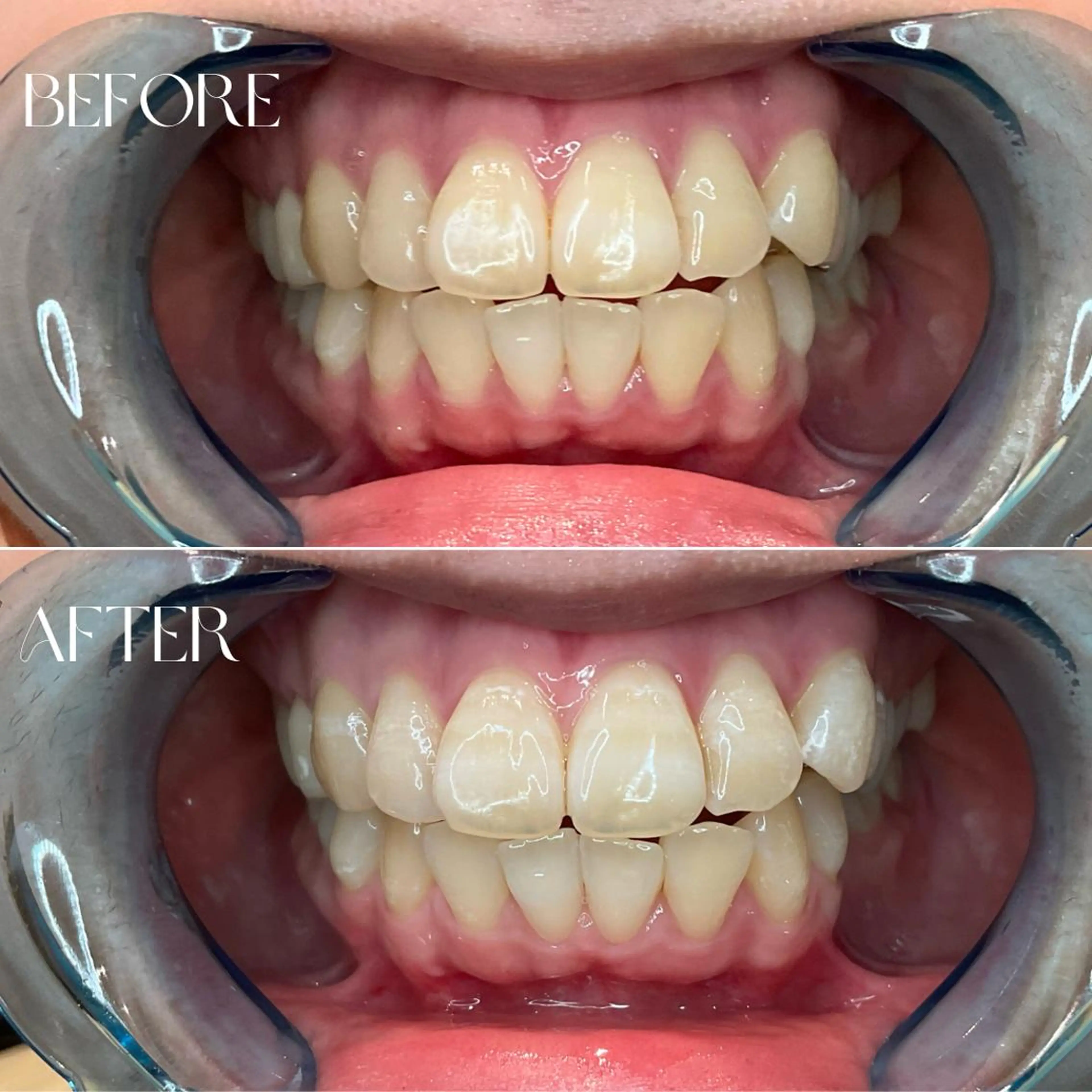 エステ B-st. 下北沢のエステ・リラクイメージ