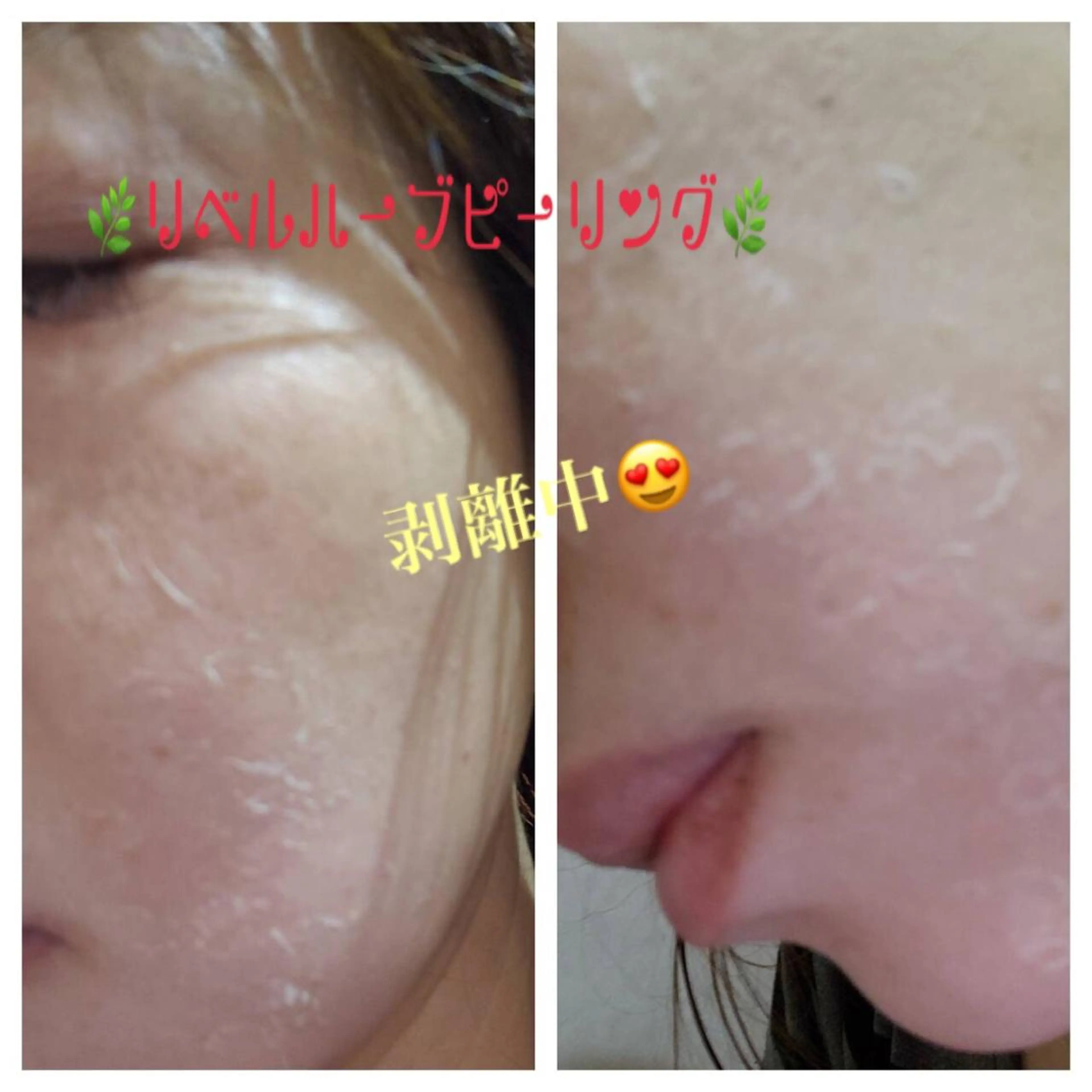 エステ 【リベルハーブピーリング認定店】敏感肌・美白脱毛専門店Dione立川店所属・Dione 立川店のエステ・リラクイメージ