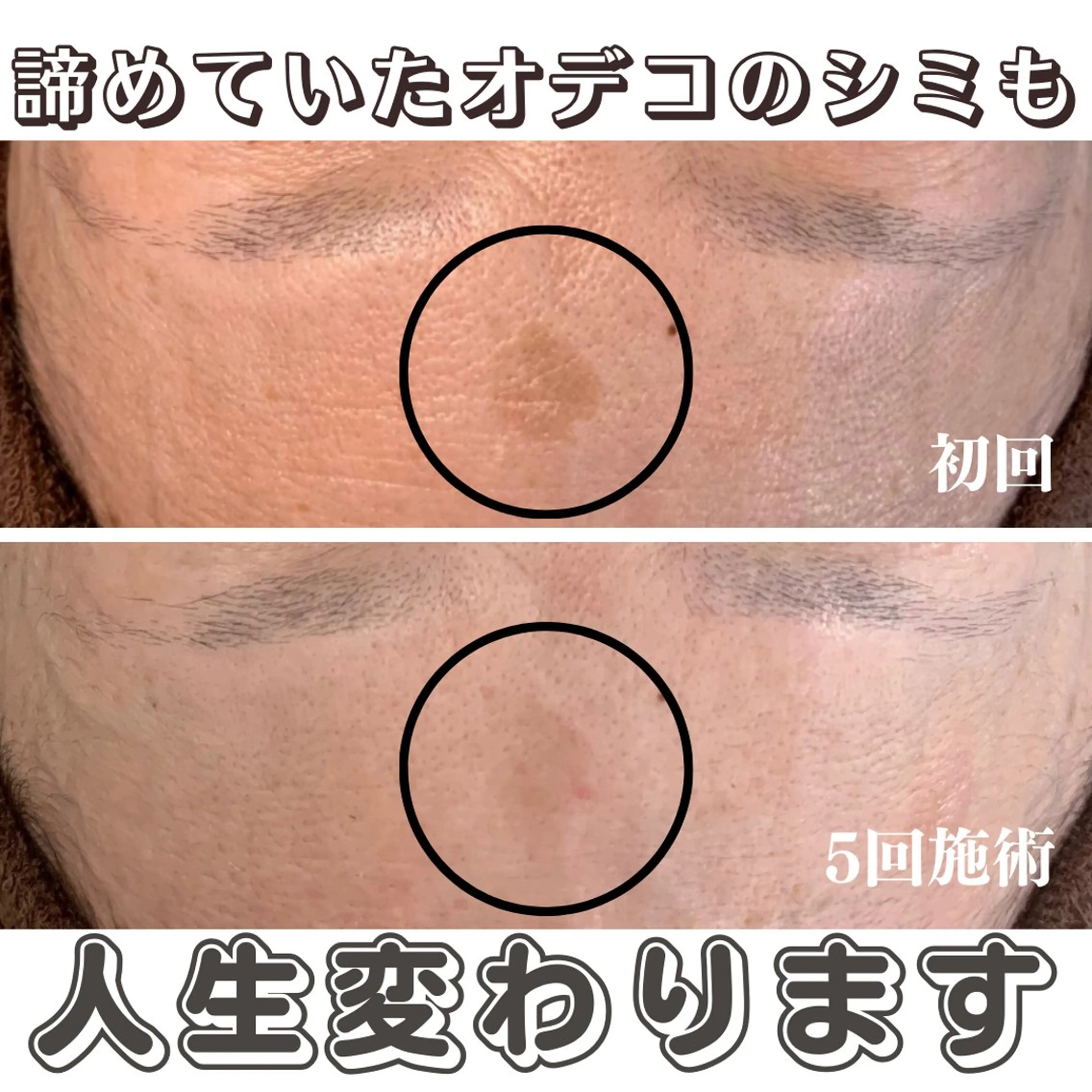 最新シミケアLily de pearlのエステ・リラクイメージ