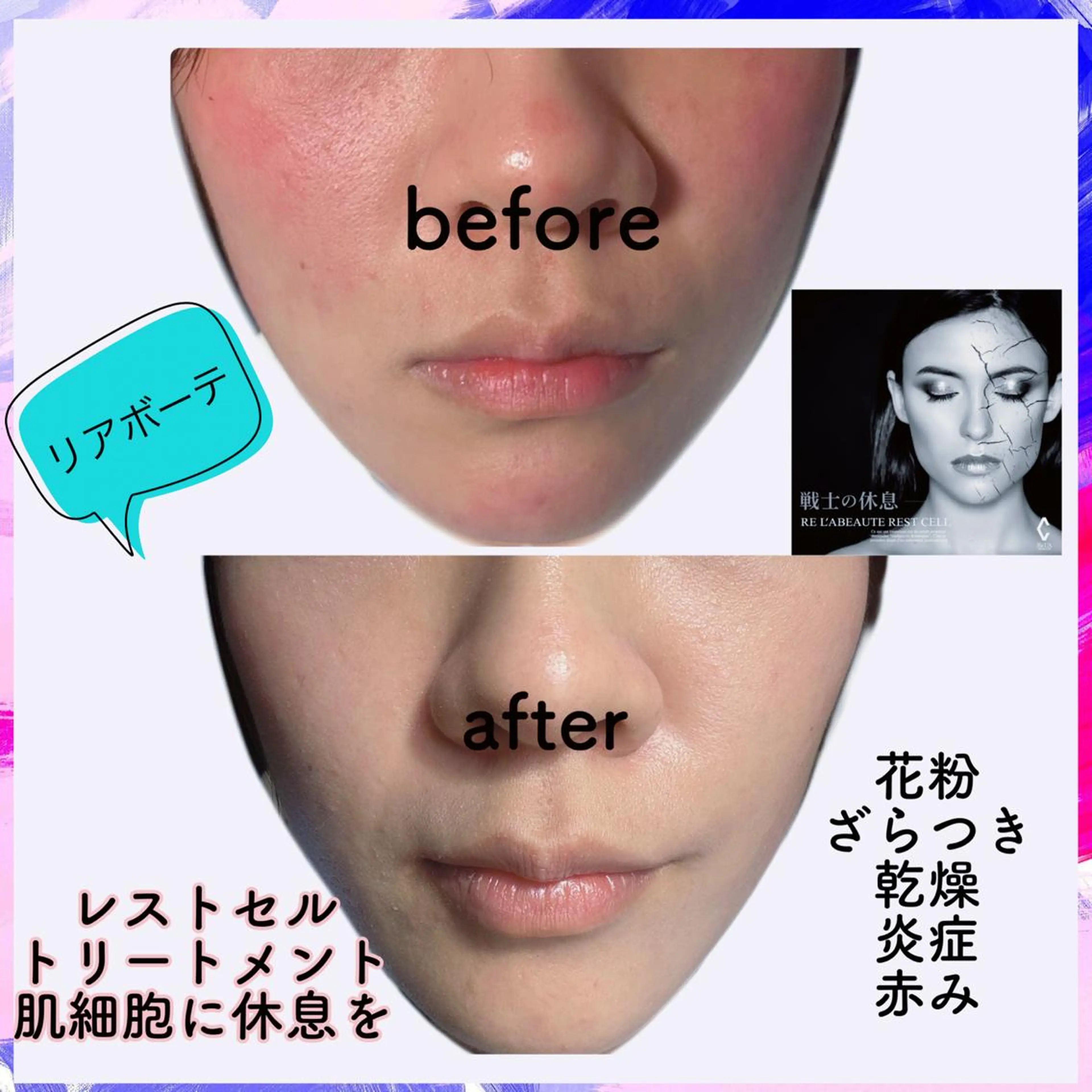 marron所属・痩身ハイパーナイフ ララピールリアボーテのエステ・リラクイメージ