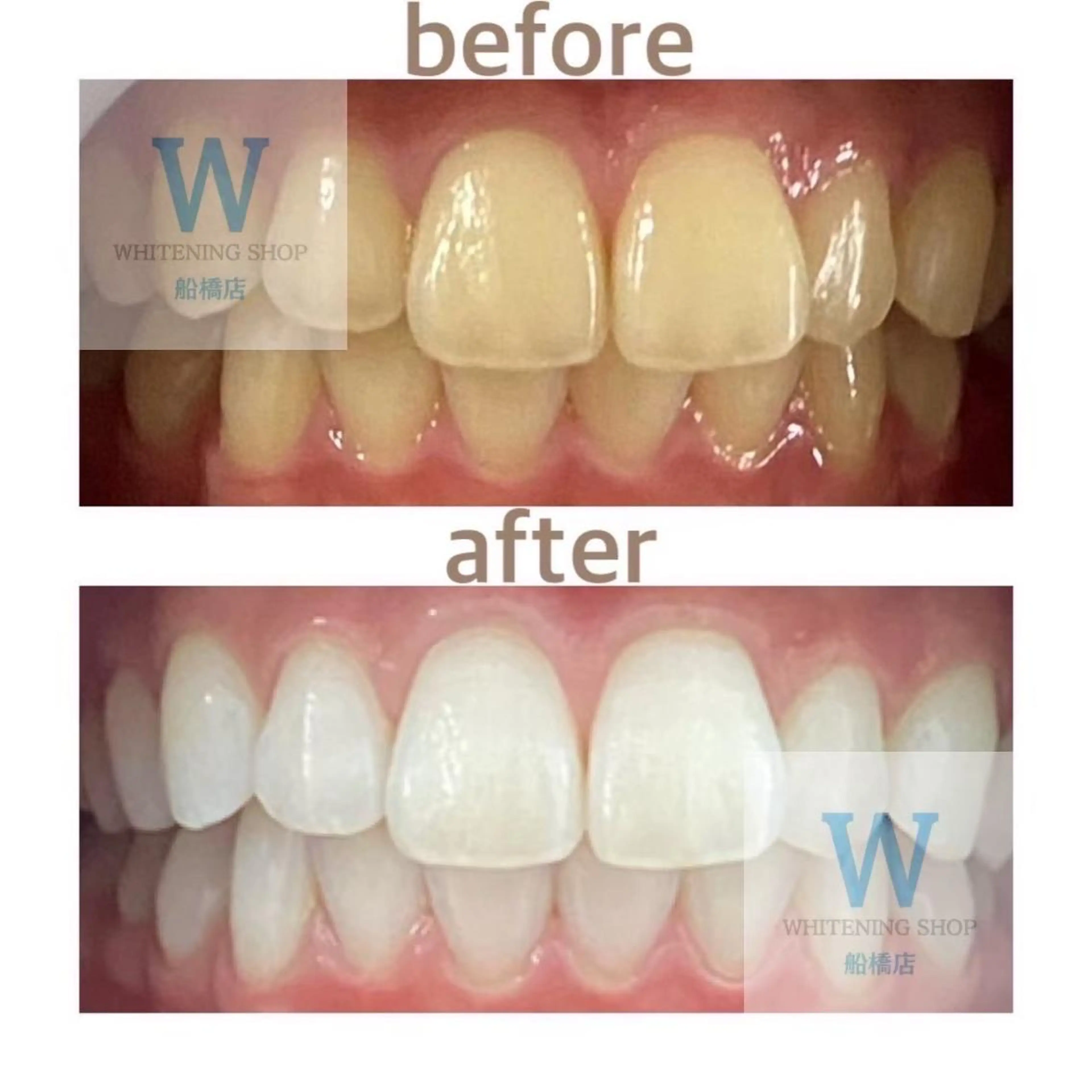 エステ リラク ホワイトニング ショップ船橋2号店のエステ・リラクイメージ