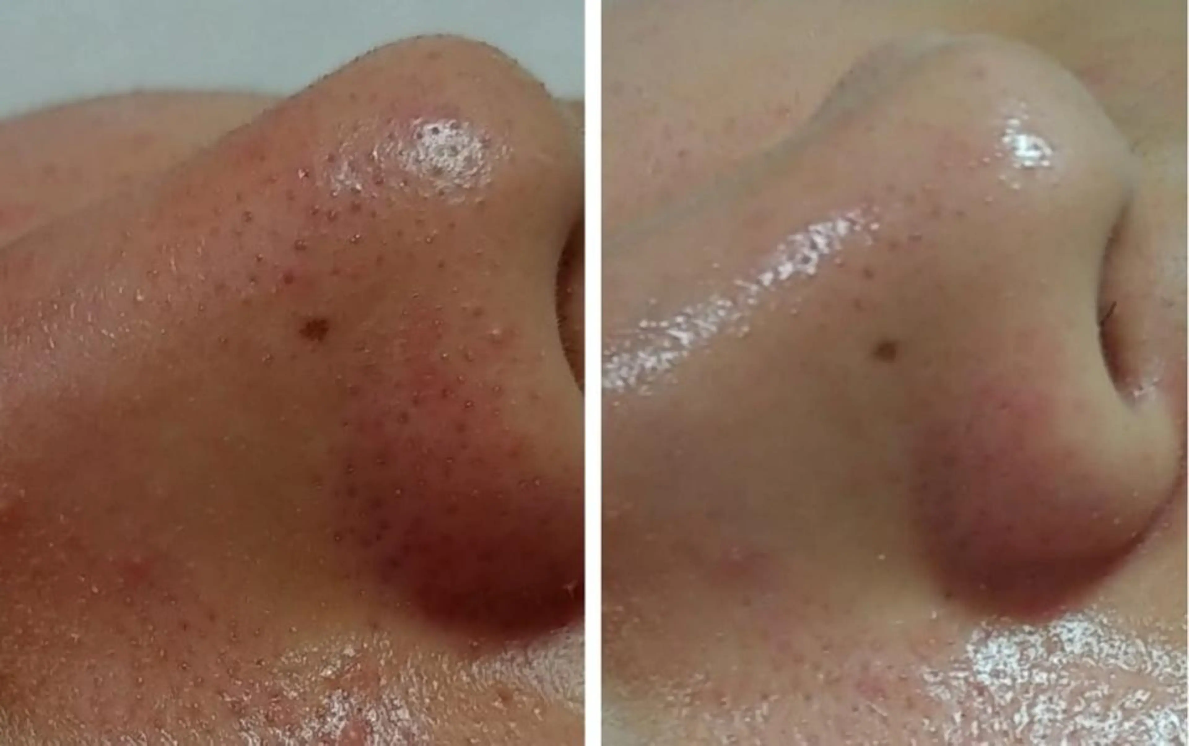 あんみっこ kitaのエステ・リラクイメージ