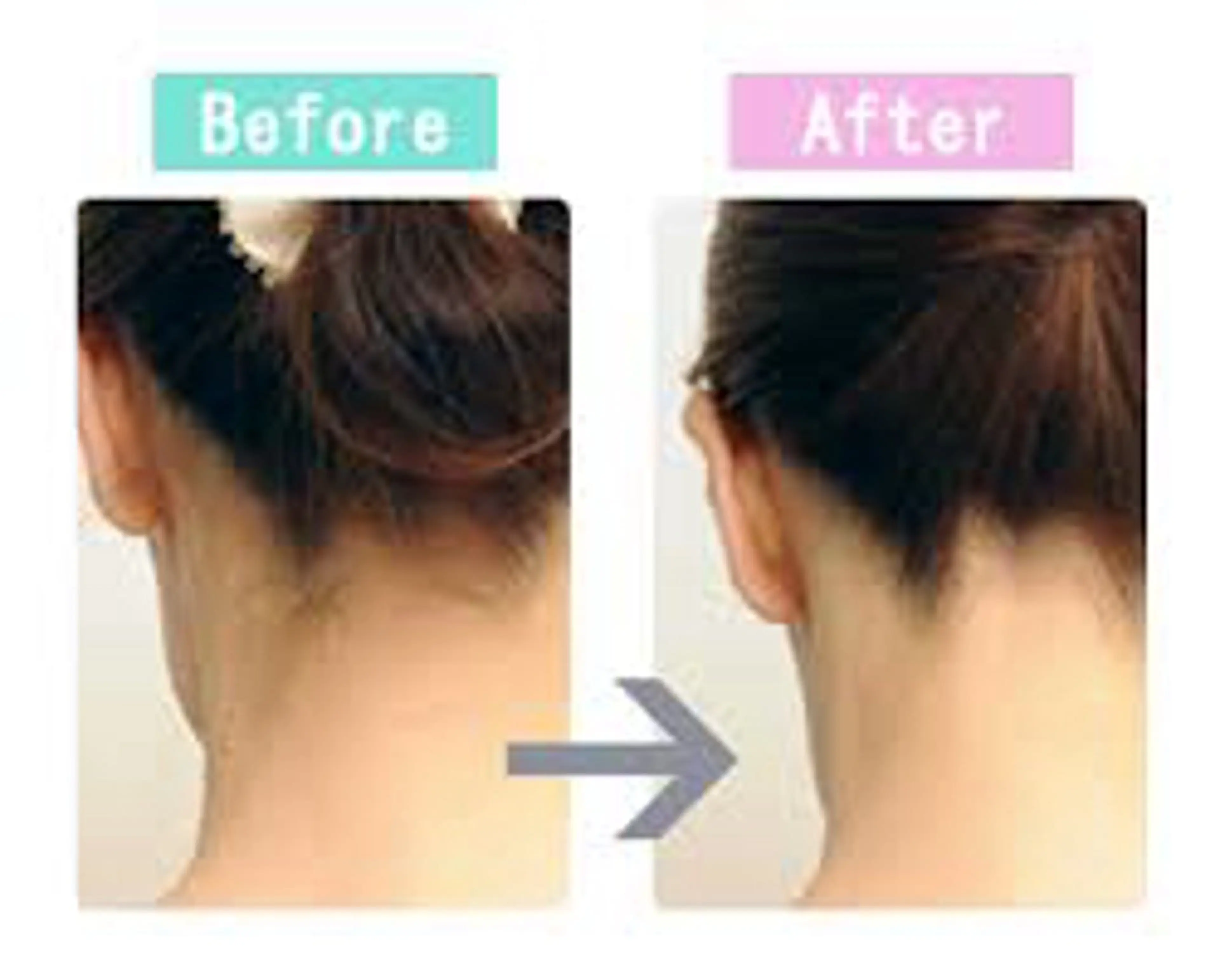 【結婚式&イベントうなじスッキリ】シェービング脱毛！予約日下記注意事項有!【挙式日など】1日～2日前迄にご予約厳守です！の写真