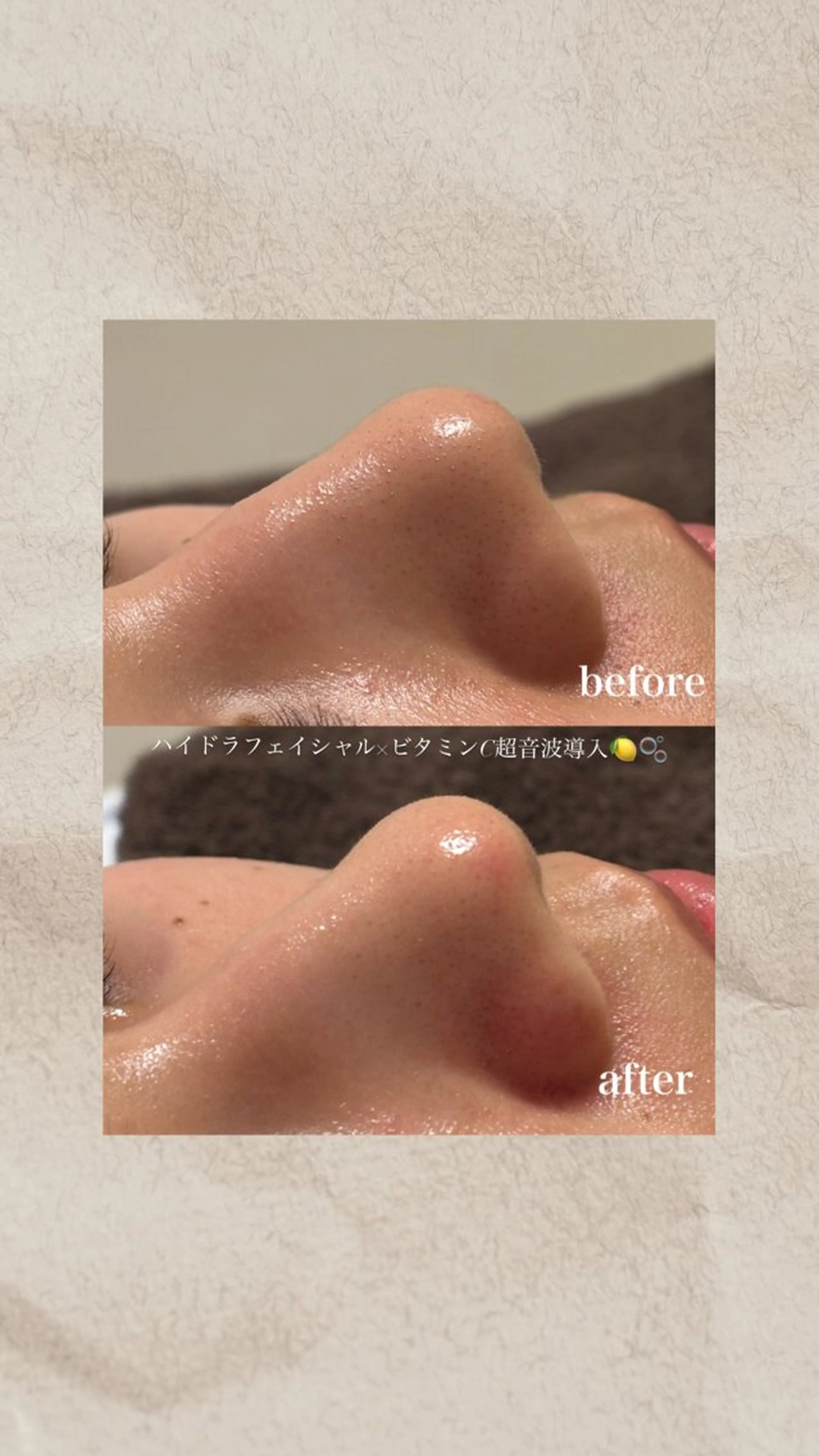 エステ 美養HAREHADA 🫧/ Ibukiの眉毛・アイブロウイメージ