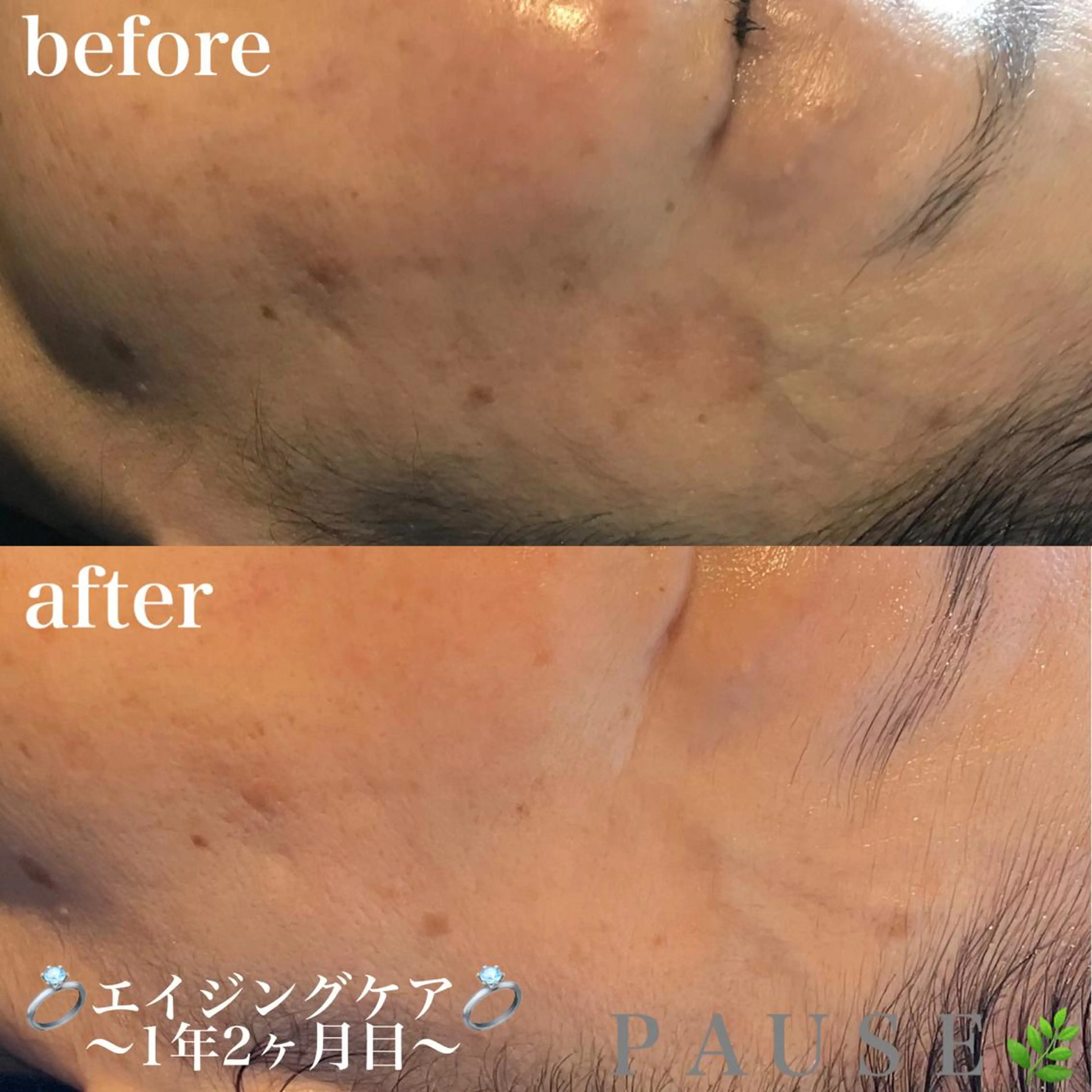 エステ 浜野 恵美のエステ・リラクイメージ