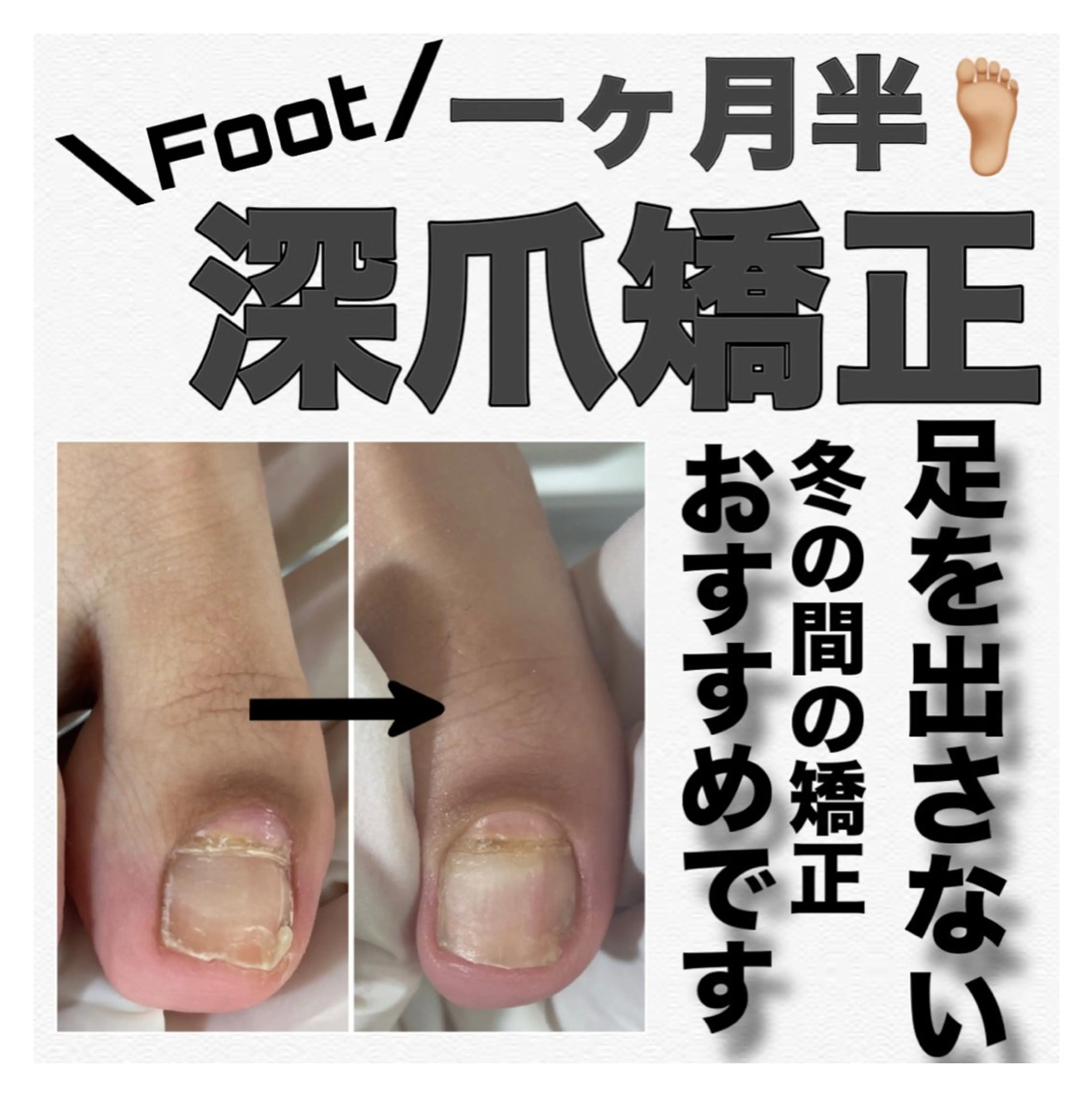 ネイル 長さ出し フットネイル ジェルネイル フットネイル petillant所属・nail salon petillantのネイルデザイン