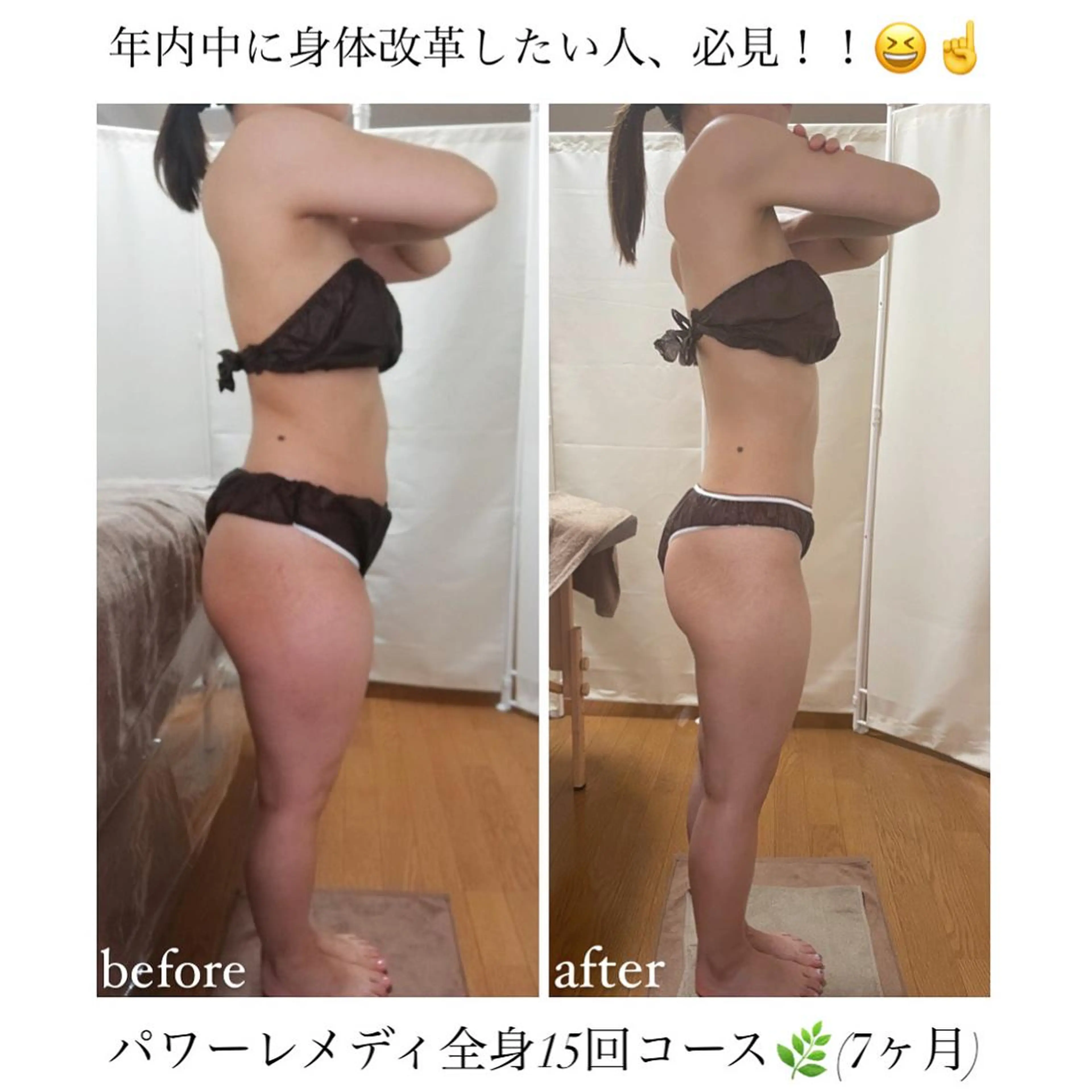 biloop所属・《痩身×疲労改善》 BILOOPのエステ・リラクイメージ