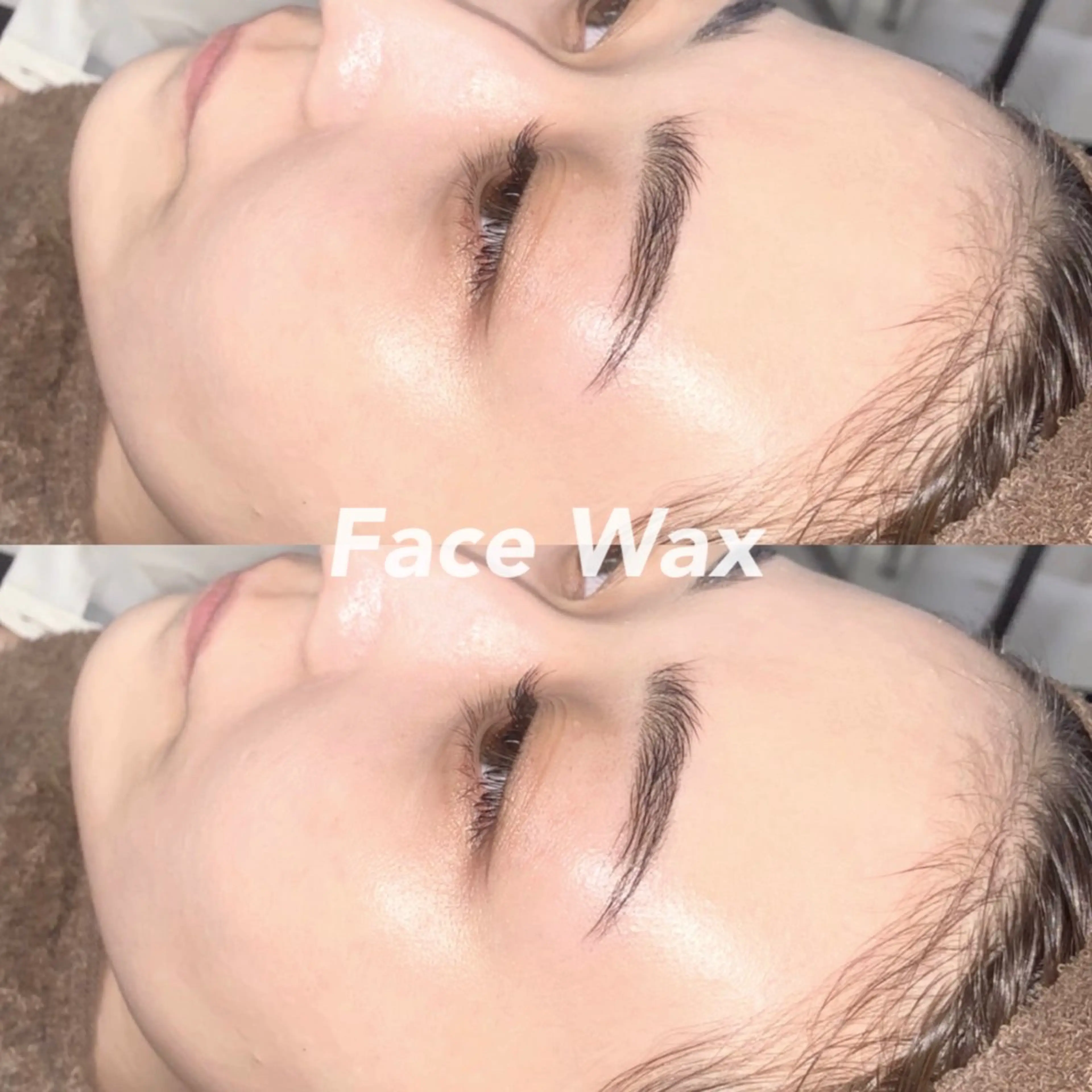 ✨全顔ツヤ肌✨フェイスWAX脱毛《施術時間 : 約90分》の写真