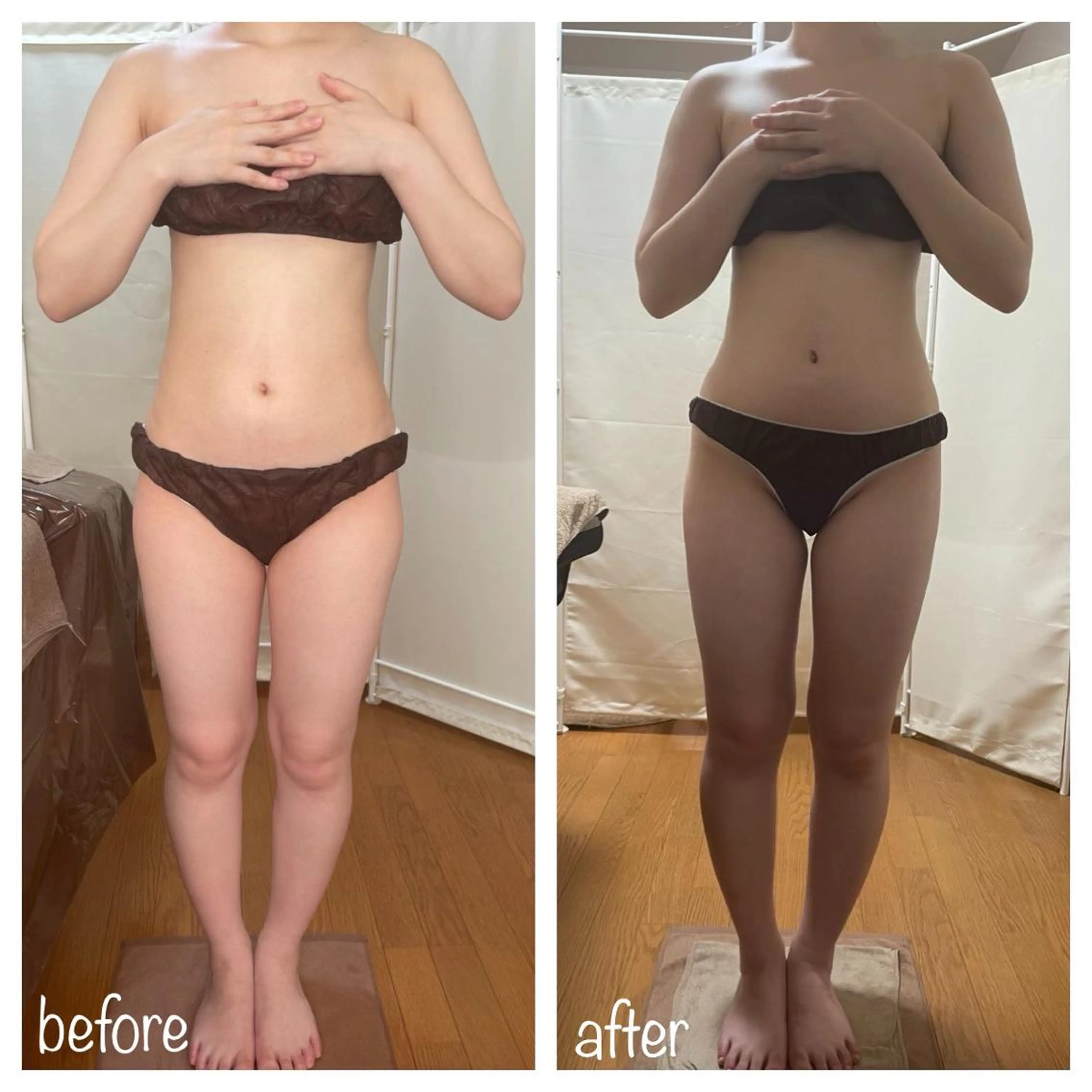 biloop所属・《痩身×疲労改善》 BILOOPのエステ・リラクイメージ