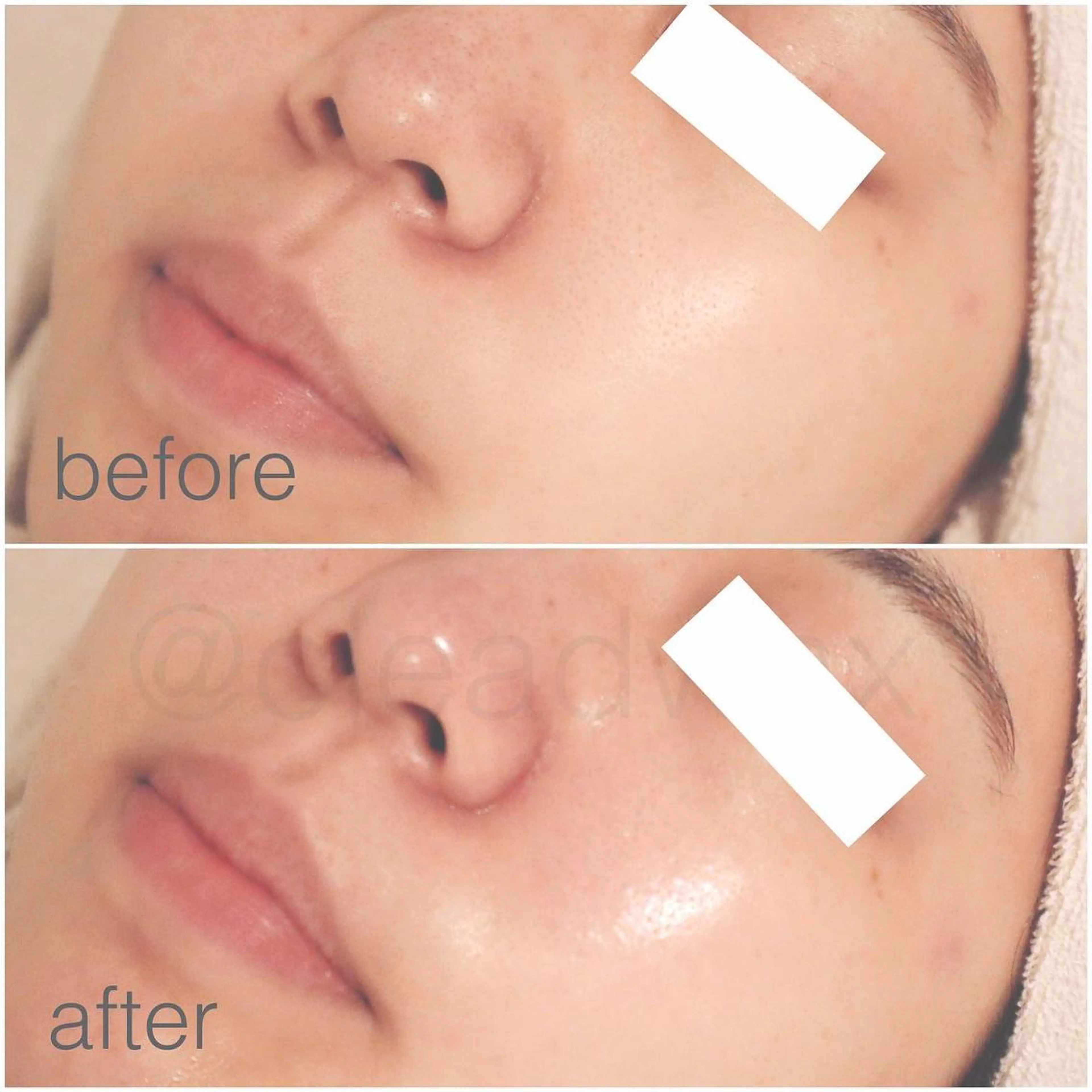 CLEAD 赤坂見附店のエステ・リラクイメージ