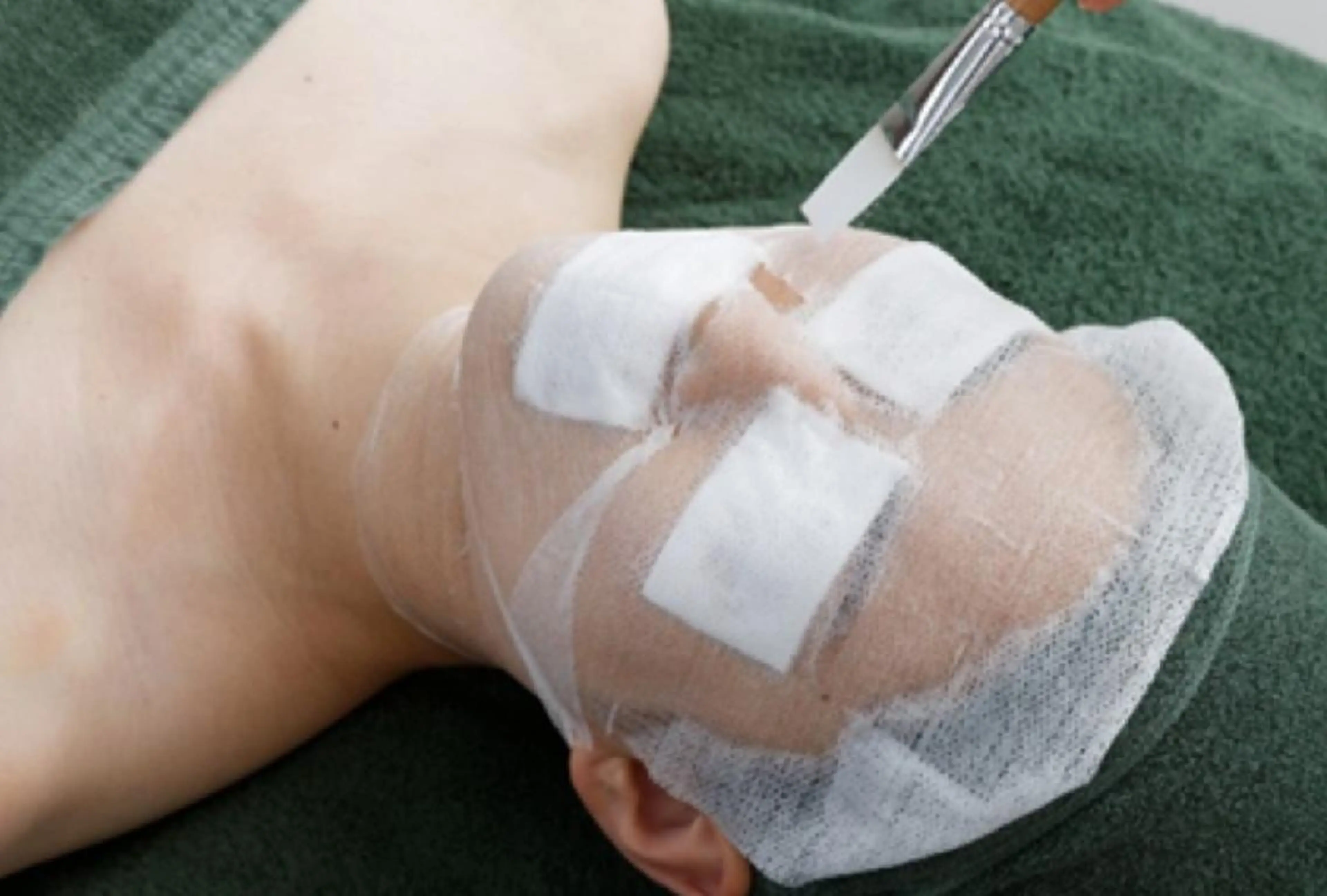 バクテリウムピールの写真