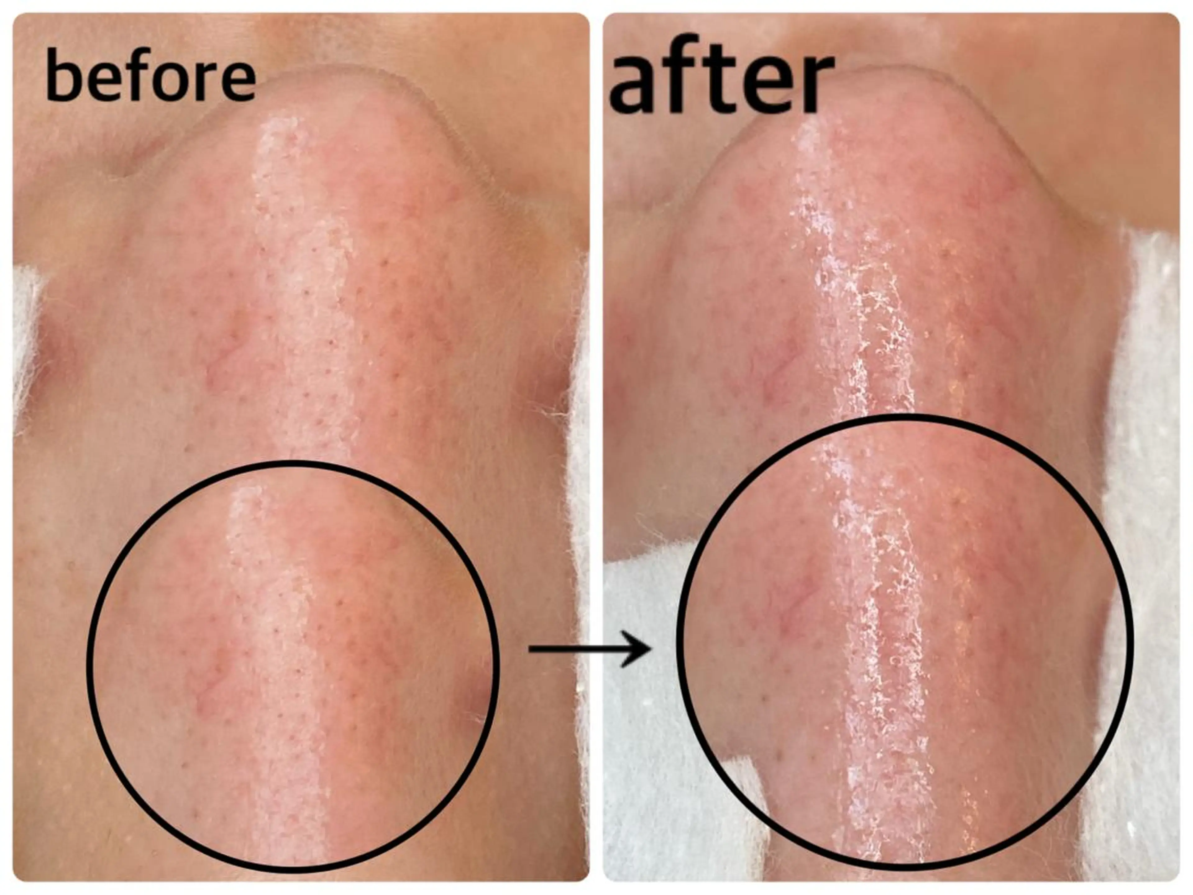韓国肌管理 【毛穴専科】のエステ・リラクイメージ