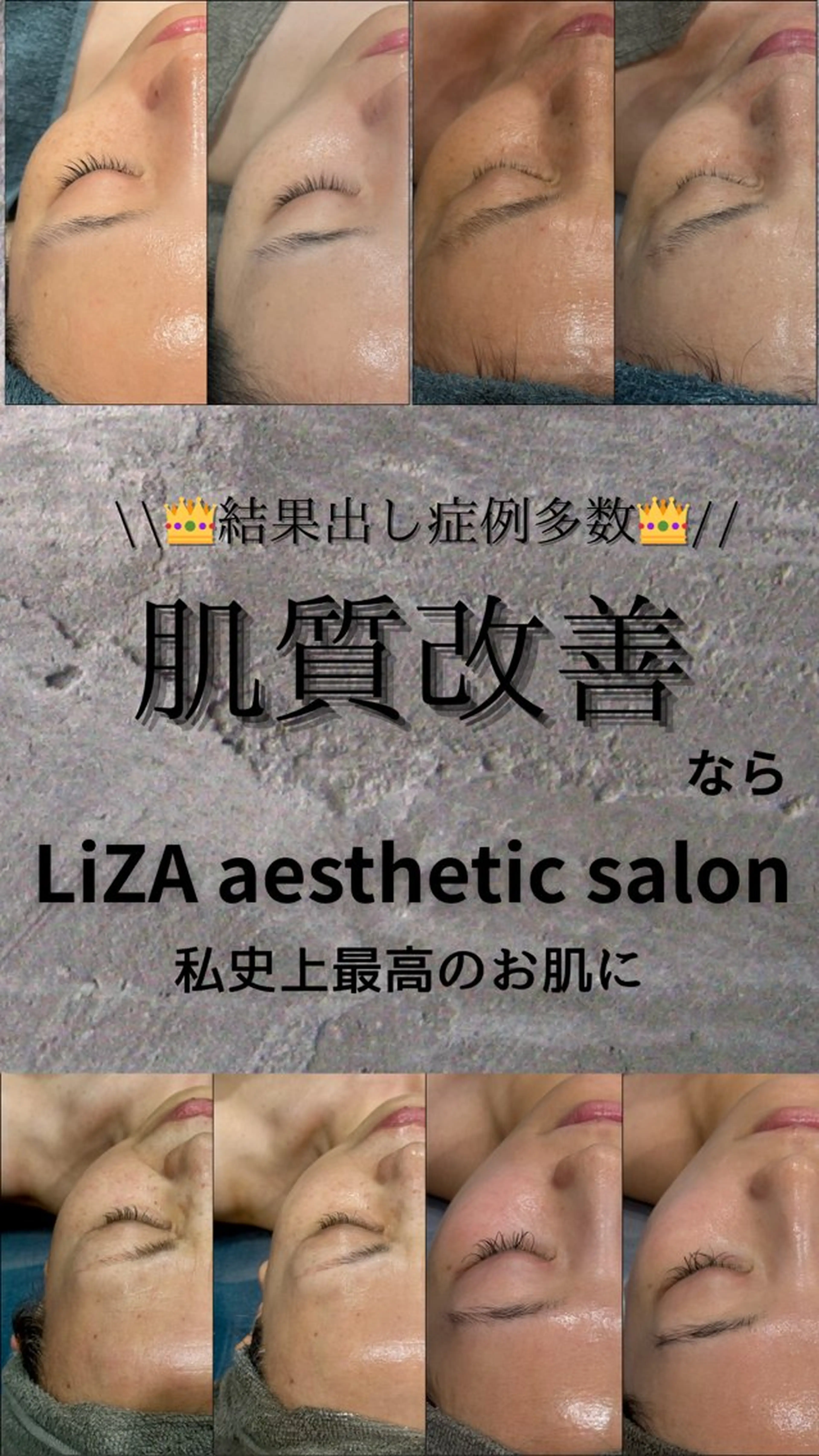 エステ LiZA エステティックサロンのエステ・リラクイメージ