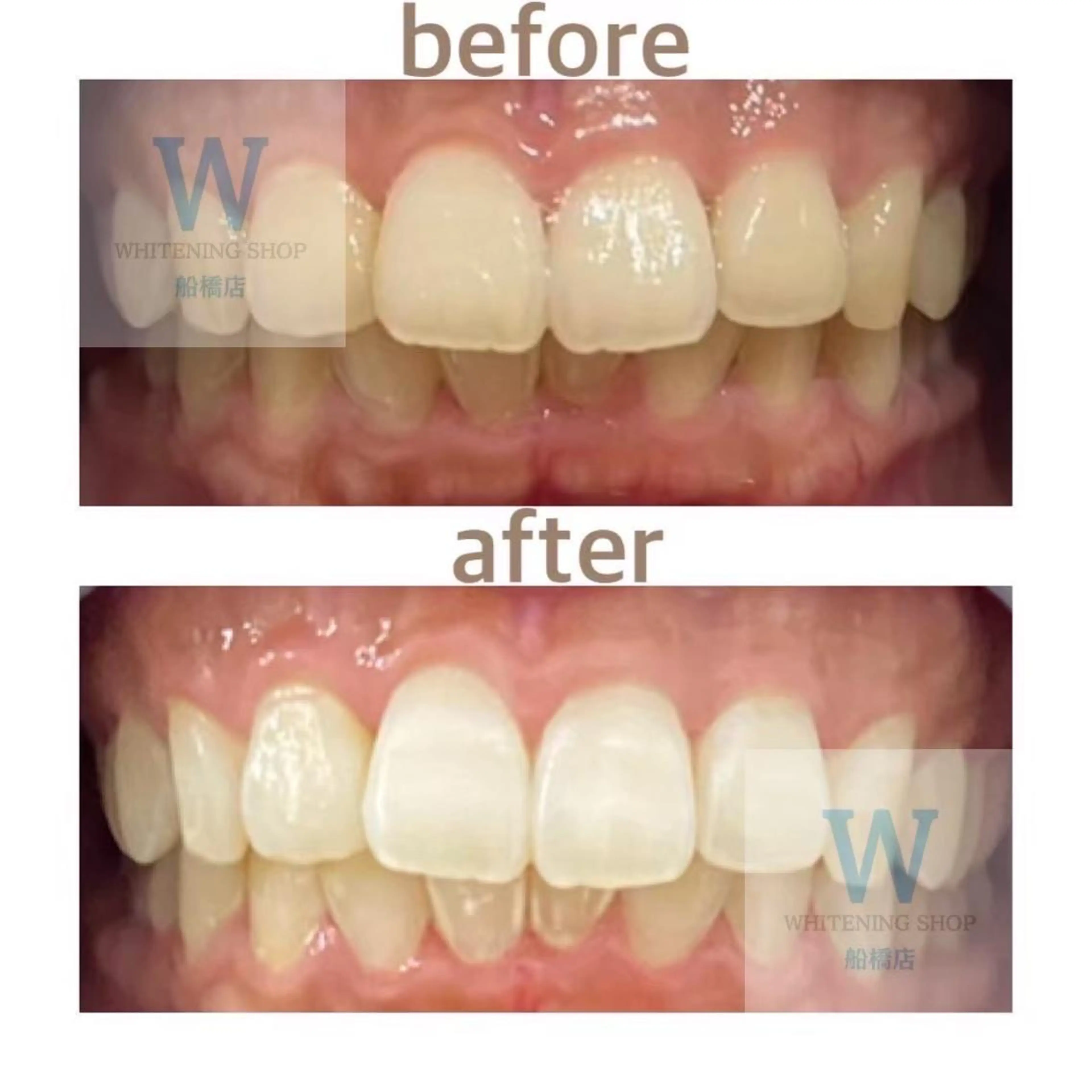 ホワイトニング ショップ船橋店🦷のエステ・リラクイメージ