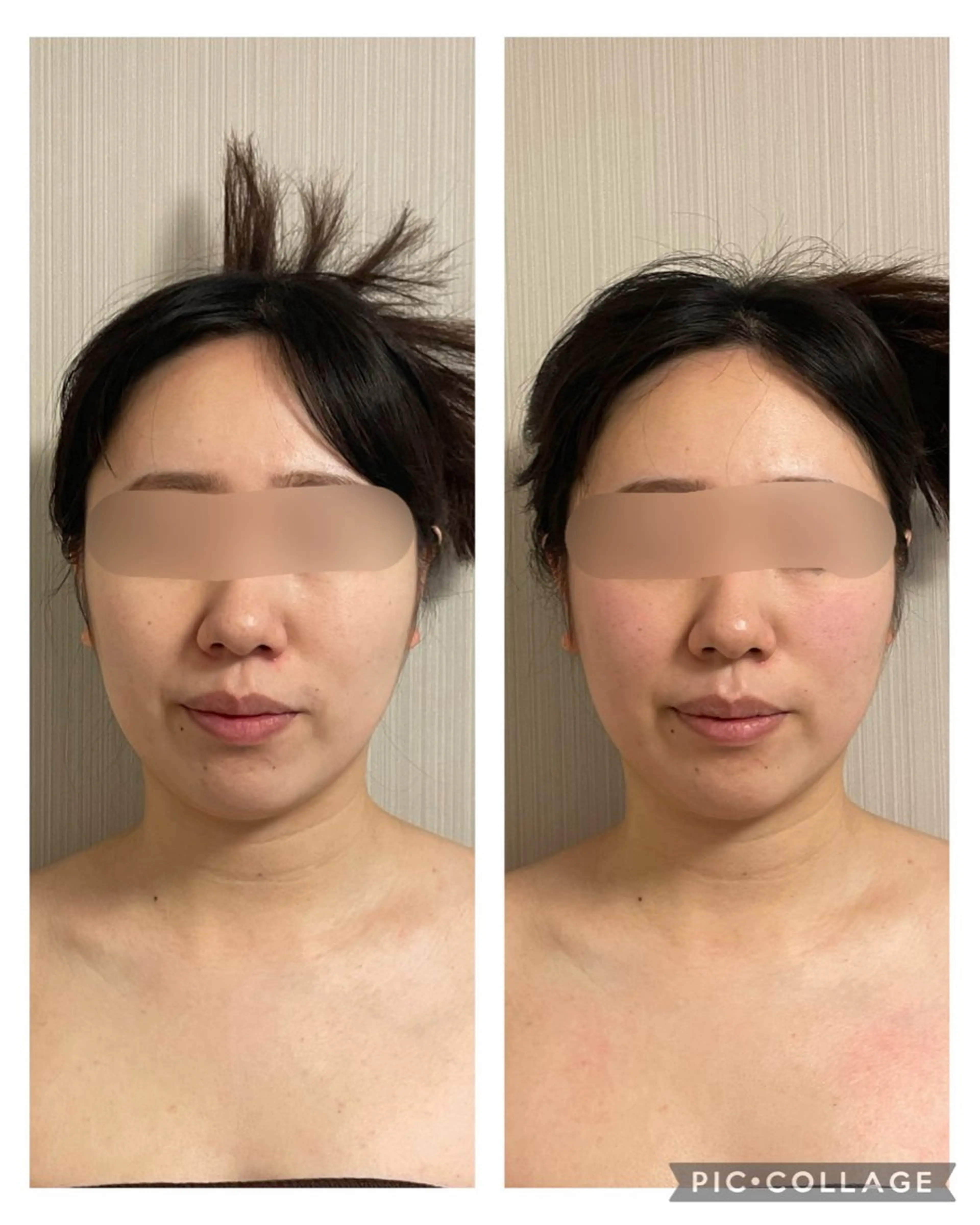 SOLUNA目黒店所属・小顔/毛穴洗浄/痩身 ayako🌿のエステ・リラクイメージ