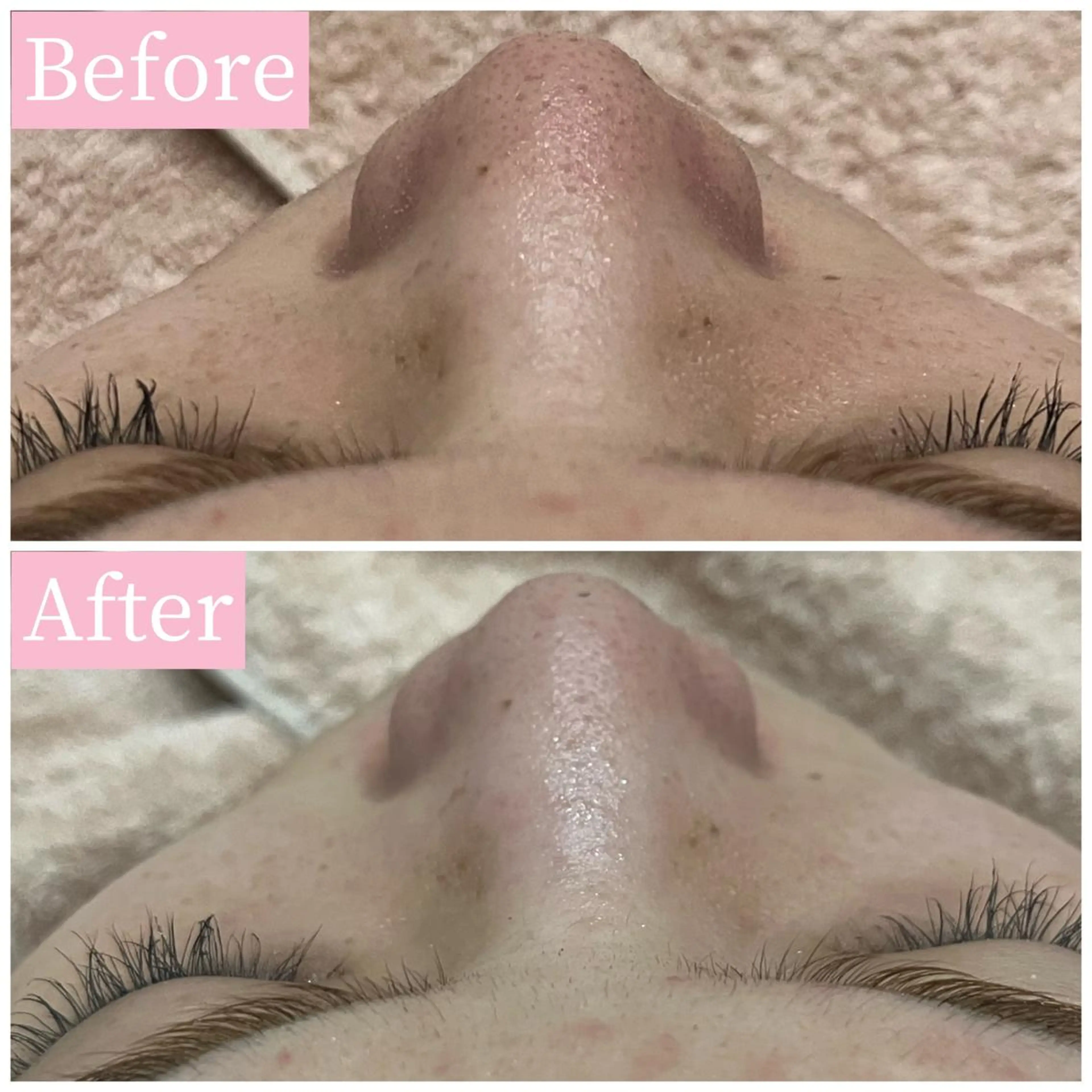 ハーブピーリング専門 muro.のエステ・リラクイメージ