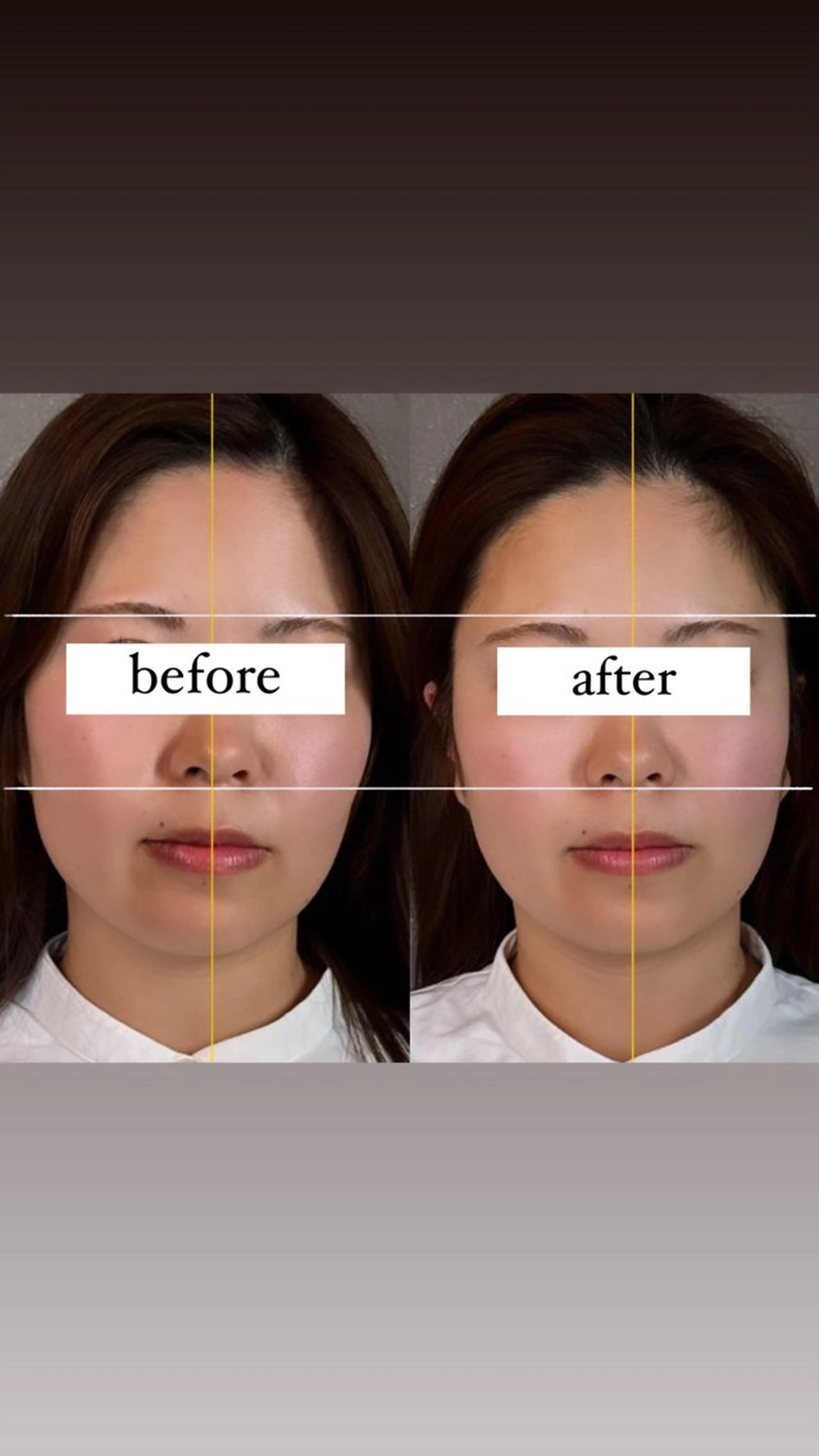 エステ ボディーメイクサロン you.meのエステ・リラクイメージ