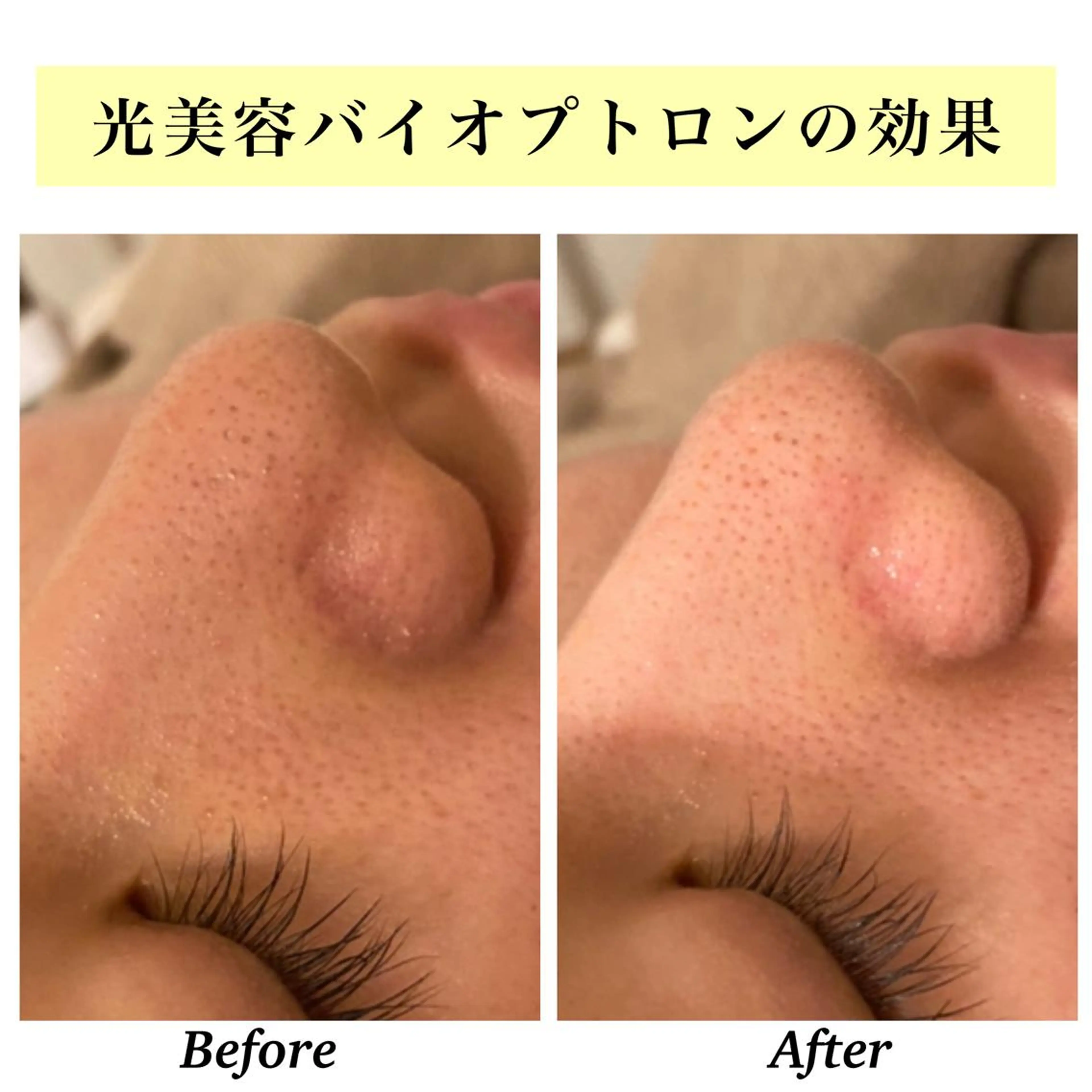 エステ リラク Bellesthe （ベルエステ）のエステ・リラクイメージ