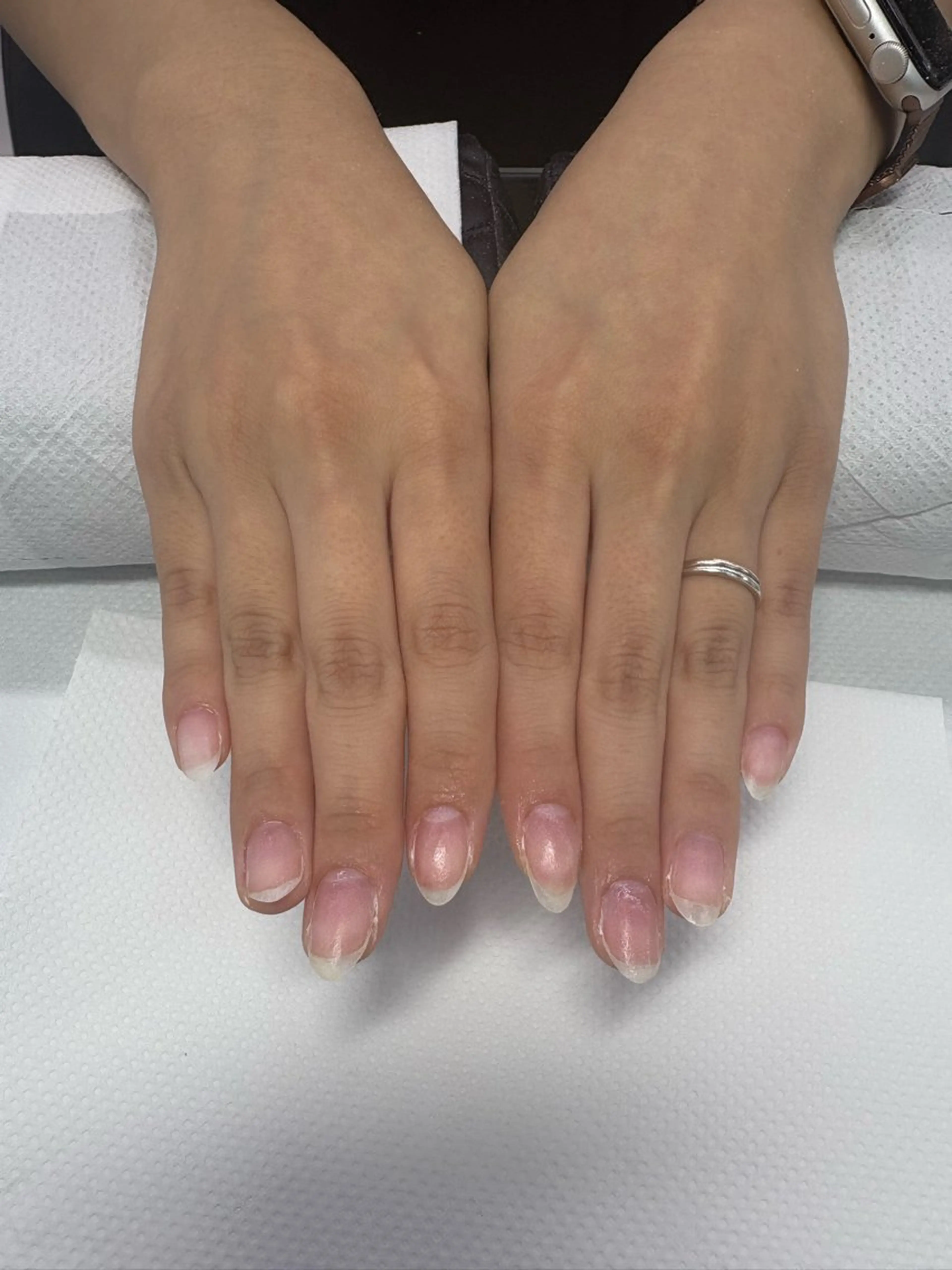 ネイル 楠本 琴音のネイルデザイン